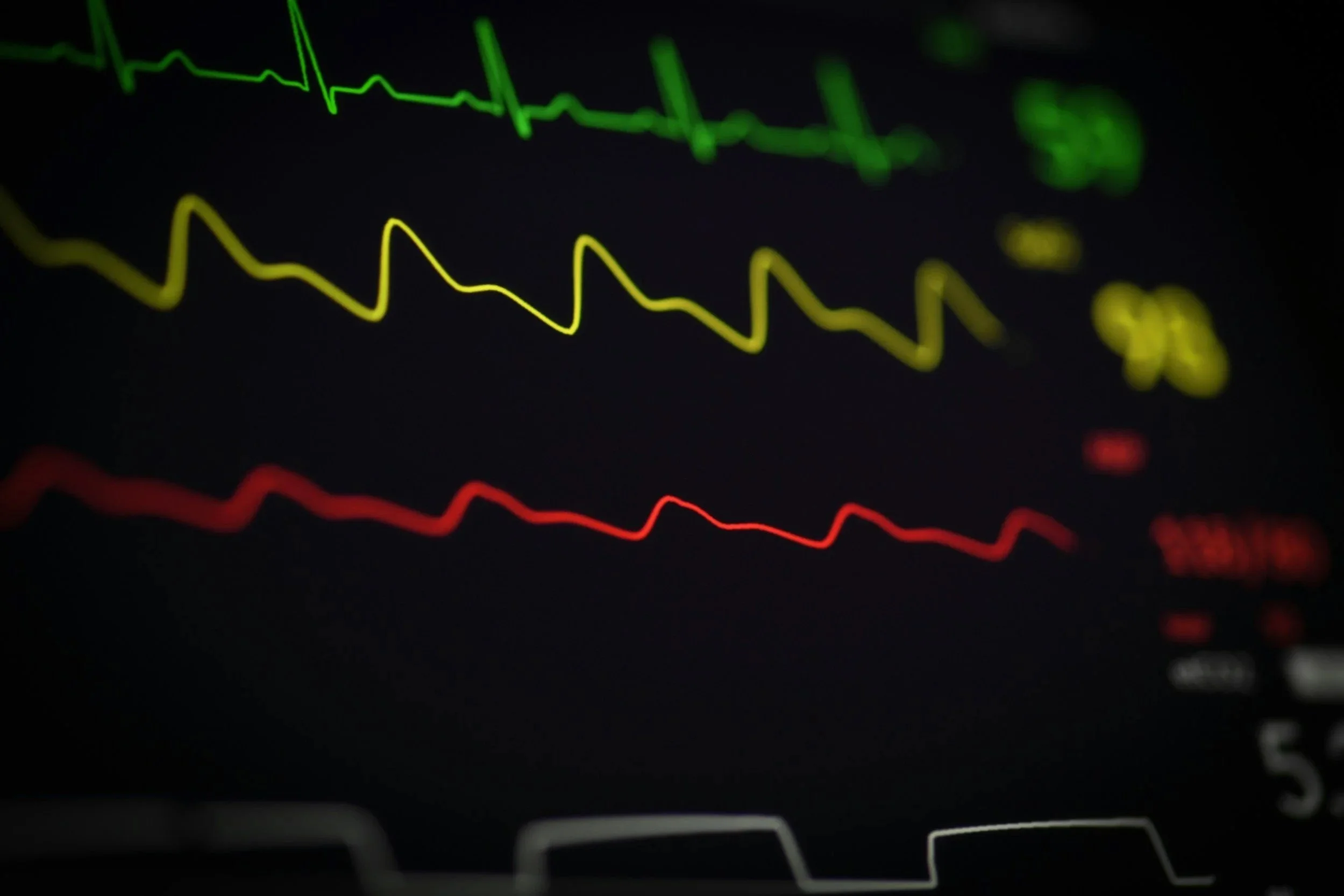 Screen di monitor cardiaco con linee di diversi colori che rappresentano battiti cardiaci variabili.