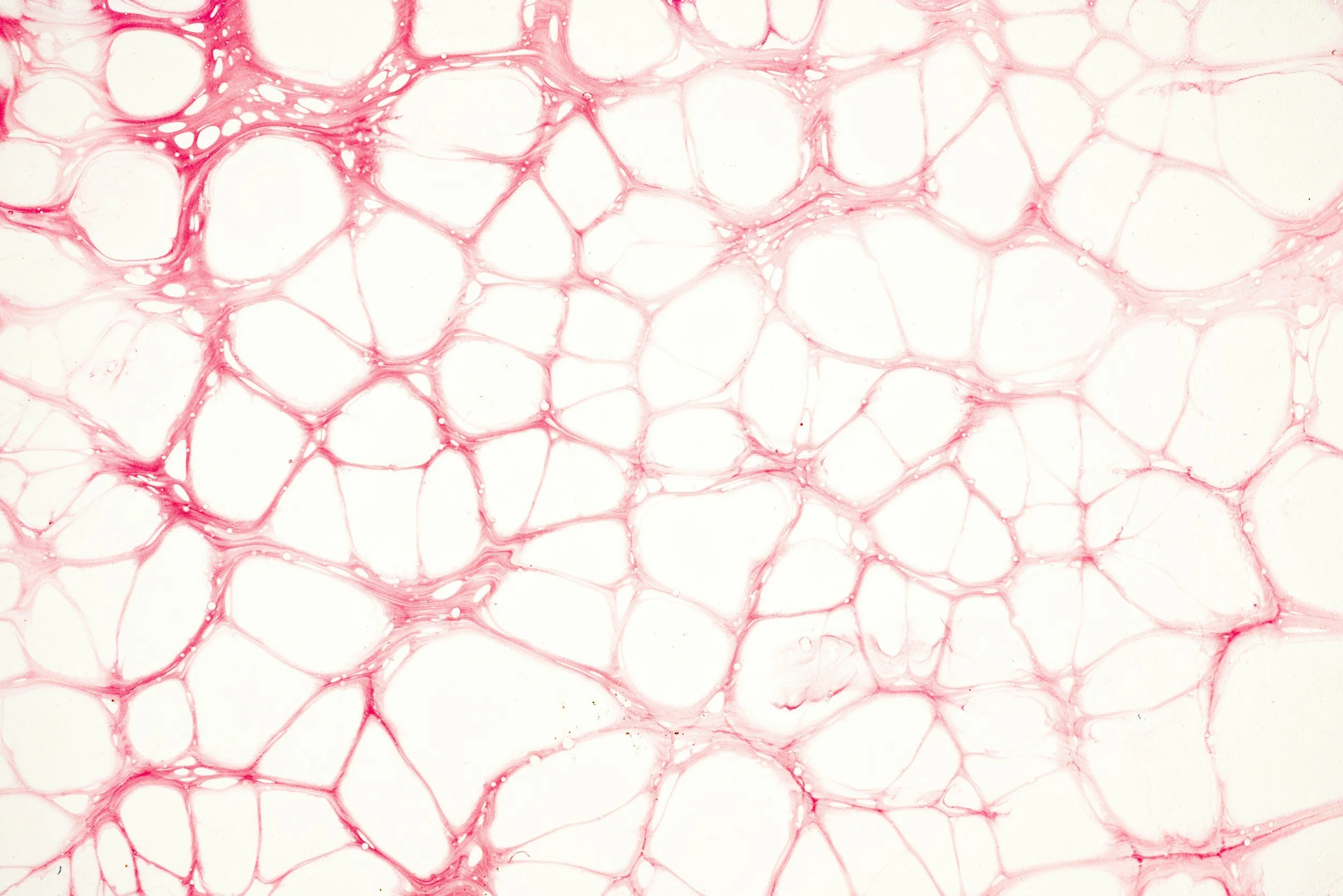 Close-up view of a soap foam with pinkish-red bubbles and thin filaments.