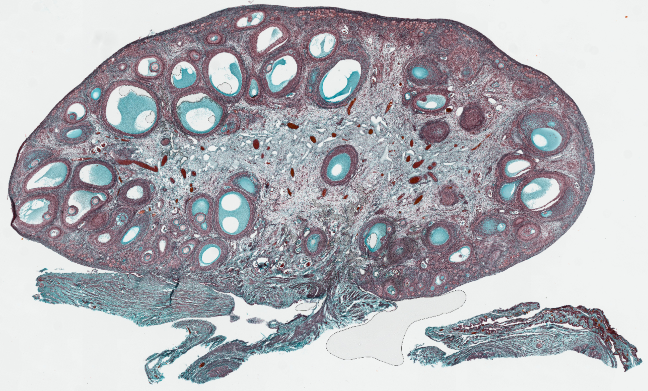 Snapshot Prueba Ovario.png