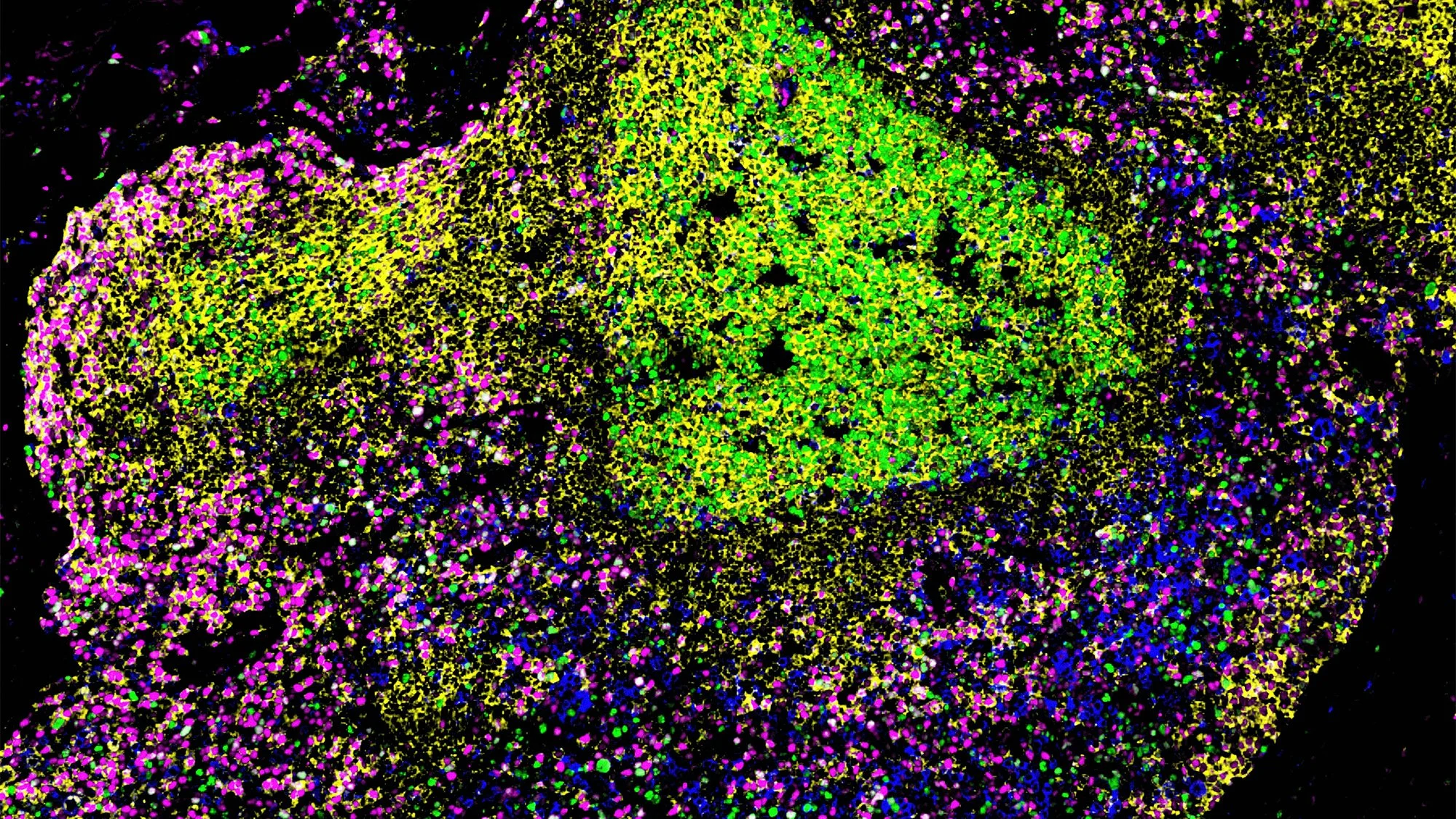 Microscopic view of brightly coloured cells or particles clustered together against a dark background.