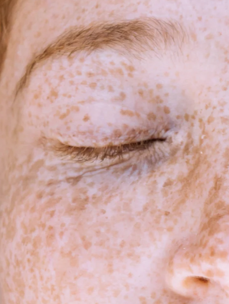 BEAUTIFUL SKIN IS BUILT, NOT BORN.