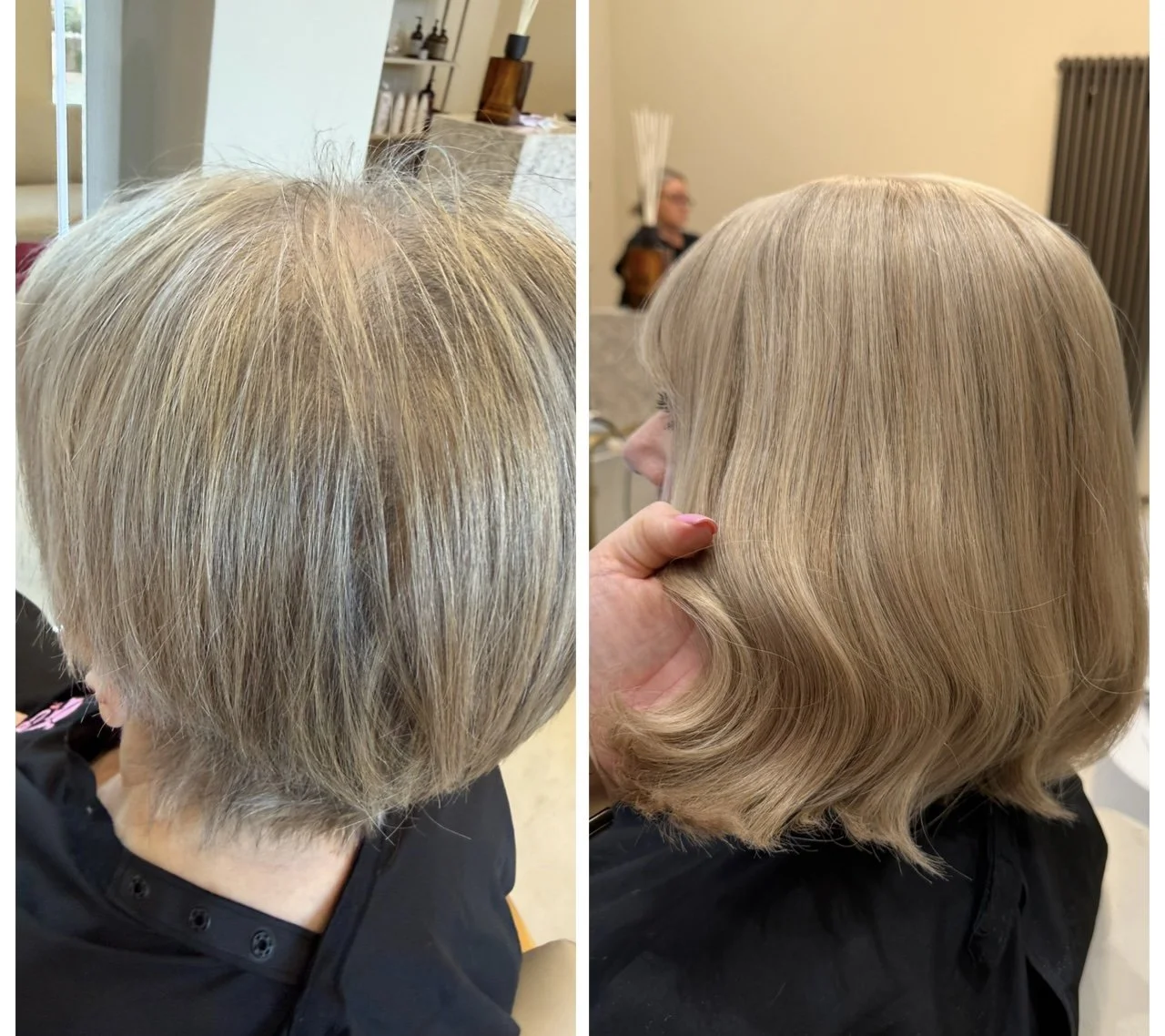 Hairloss System using Hair Dreams Micro Lines