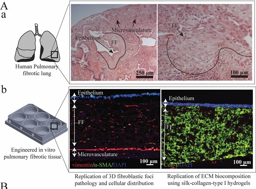 Fibroblastic foci like tissue_1.jpeg