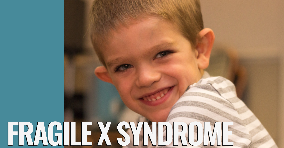 Fragile X Syndrome