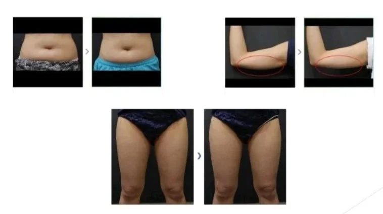 Comparison photos showing changes in body fat and muscle tone, with a focus on the abdomen, arms, and thighs, indicating before and after results of a fitness or weight loss program.