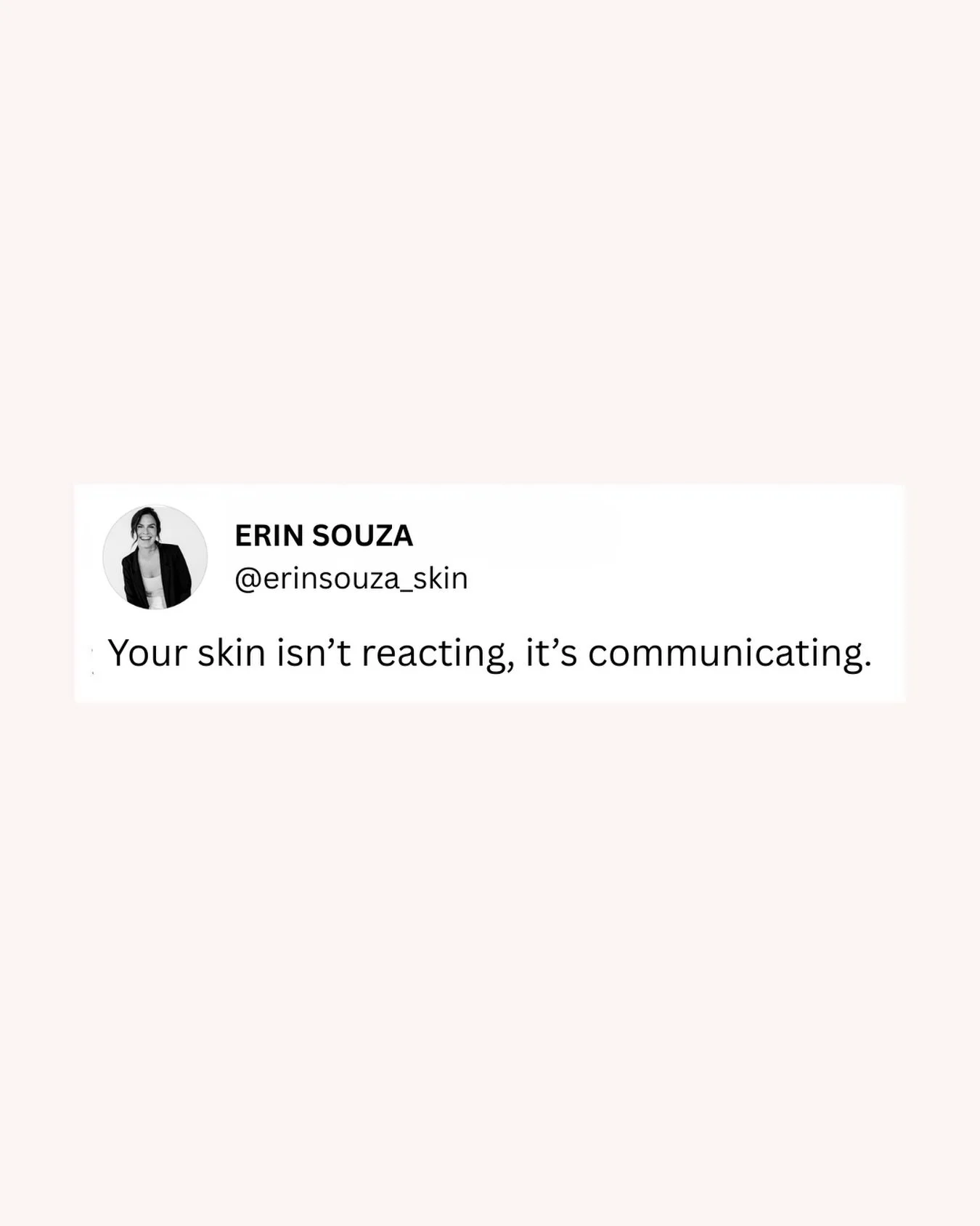 We need to listen to it, support it, and bring it back into balance with care that goes deeper than the surface.

Because when you understand what your skin is saying, everything changes.

#skincare #columbusfacial #columbusesthetician