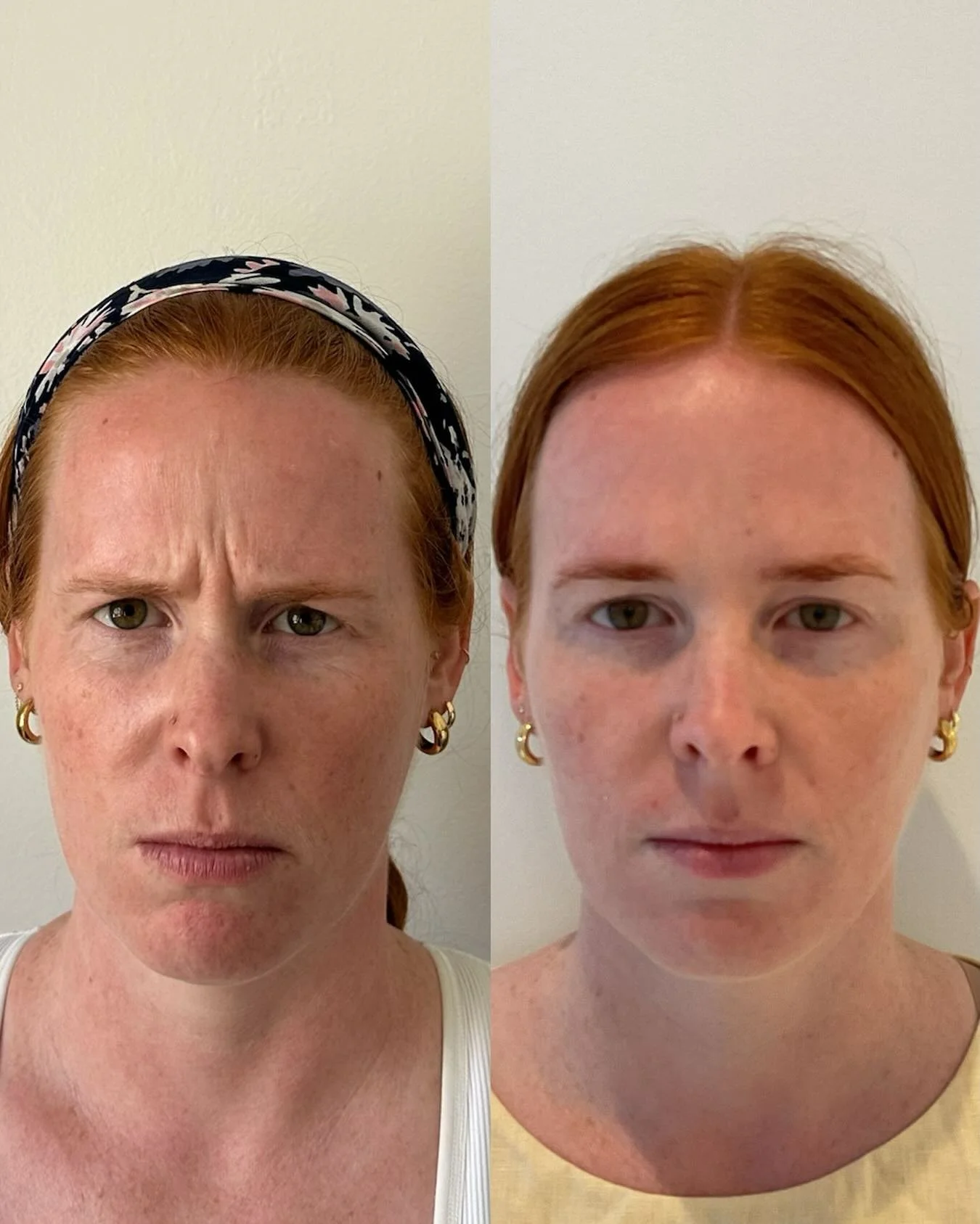 This gorgeous redhead is so much more than a before and after. She&rsquo;s a daughter, sister, wife, soon to be aunt, a dedicated nurse, and the biggest supporter of her future Perinatologist husband.
I&rsquo;d heard about her for years before I ever