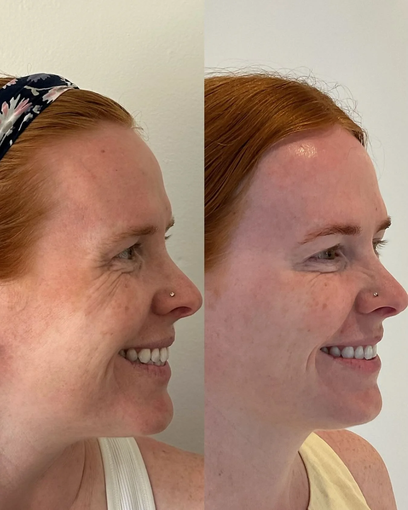 This gorgeous redhead is so much more than a before and after. She&rsquo;s a daughter, sister, wife, soon to be aunt, a dedicated nurse, and the biggest supporter of her future Perinatologist husband.
I&rsquo;d heard about her for years before I ever
