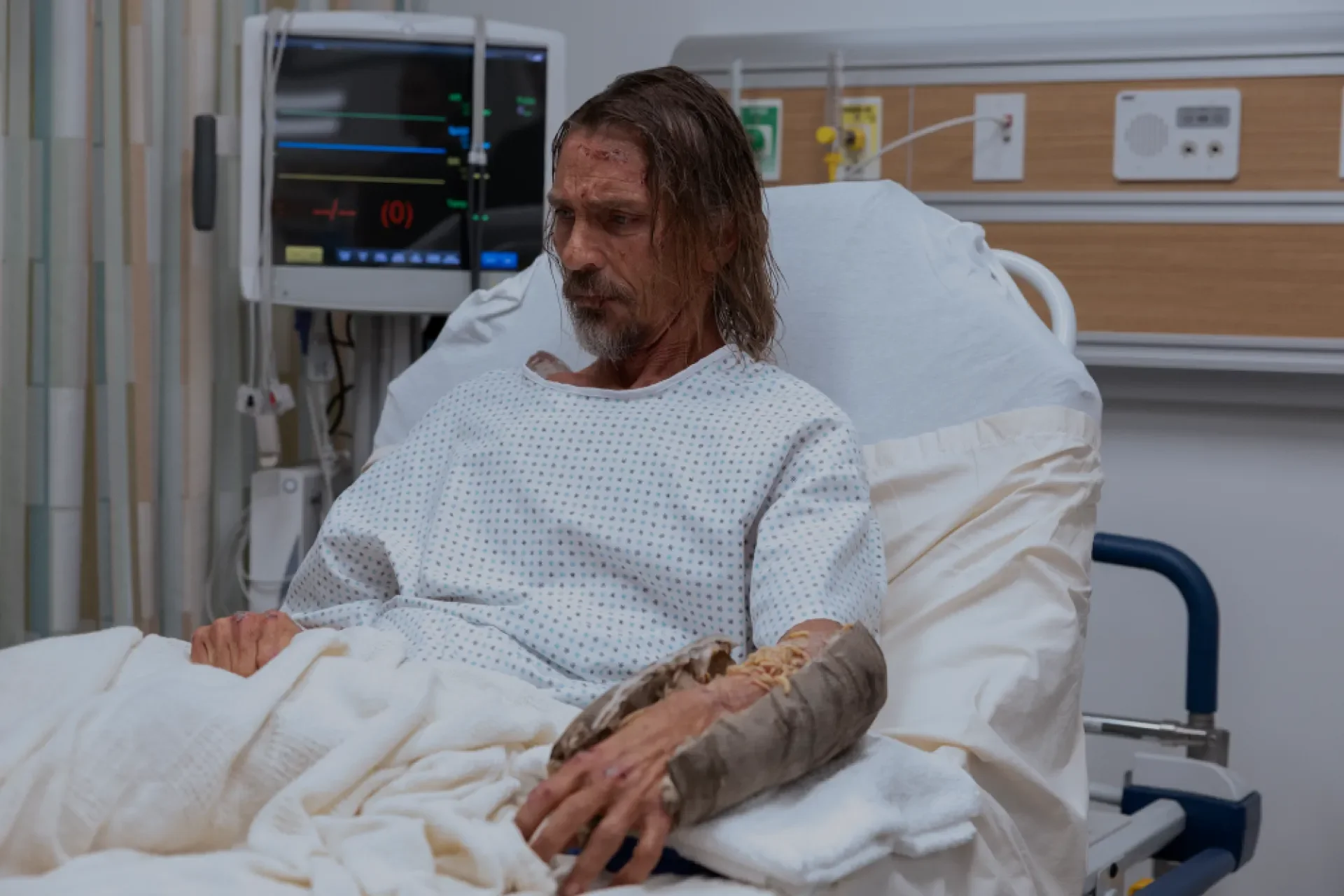 ‘The Pitt’ Makeup Head Unpacks the Show’s Goriest Moments, From a Bloody Head Flap to Tongue Lacerations