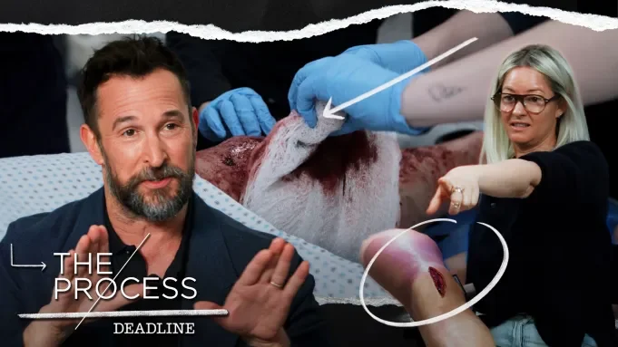 Noah Wyle &amp; Makeup Department Head Myriam Arougheti On The Practical Effects Behind Season 2