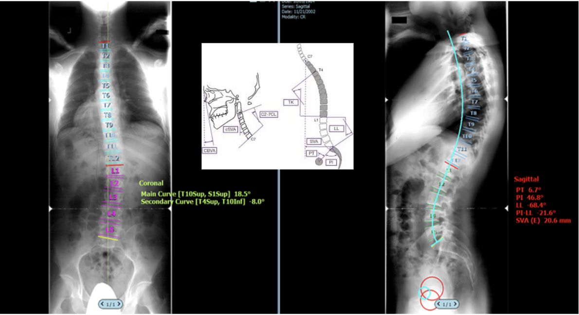Software programs available that perform measurements!