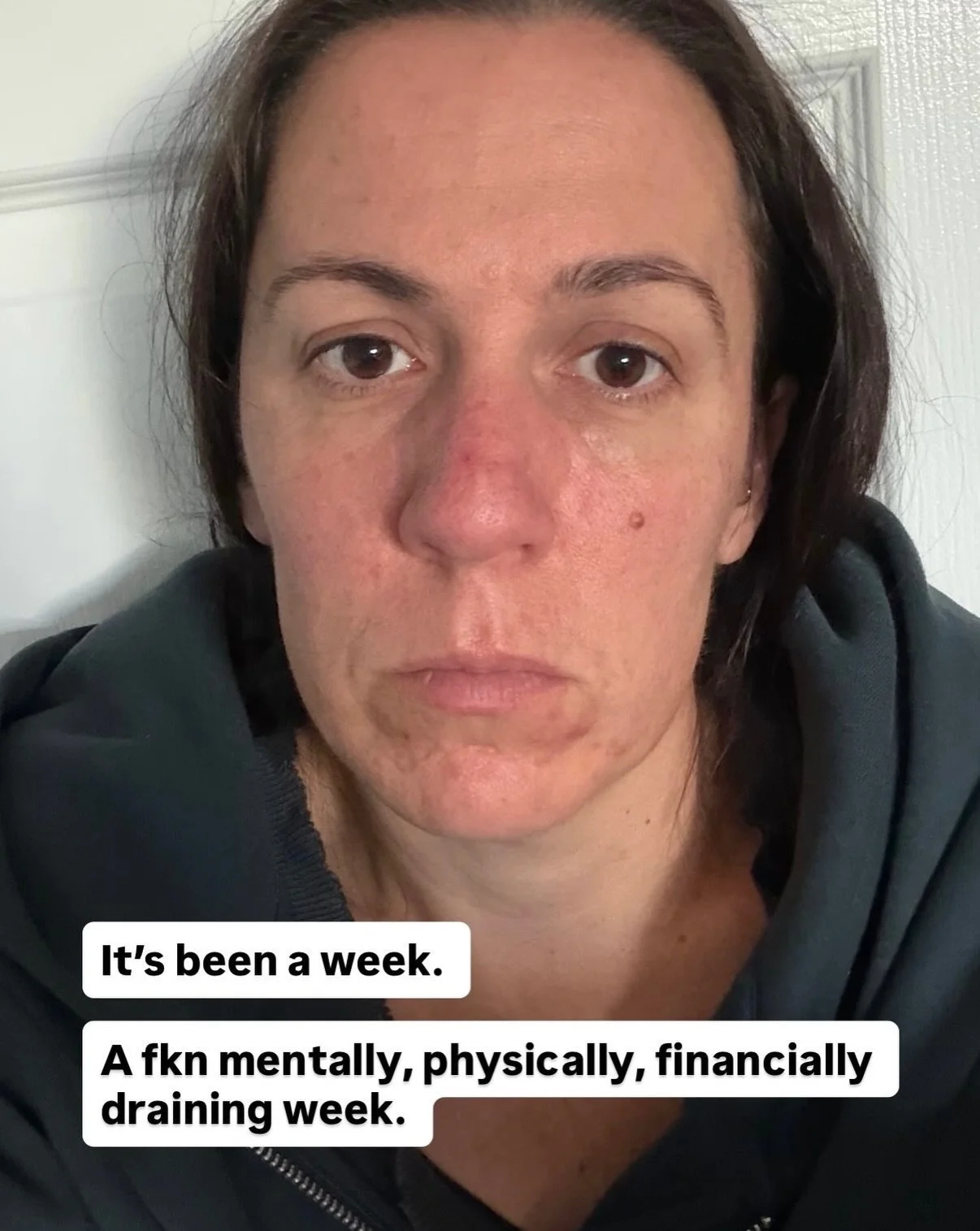 Behind the scenes in emojis 
💩🦷🤮😮&zwj;💨😴🤯😭🥰😘🥹🙏🏼🌈❤️&zwj;🔥🏋🏽&zwj;♀️🧘🏽&zwj;♀️🍞👯&zwj;♀️🐶💔😢

#colonoscopy #wisdomteethremoval #personalgrowth #shadowwork #somaticcoaching