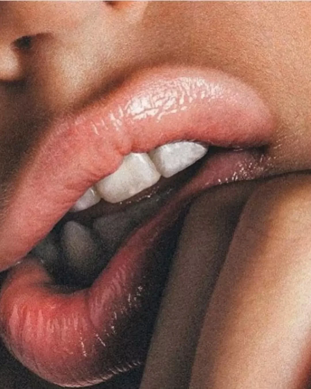 The lips play an important role in overall facial balance. With time, changes in volume, definition or hydration may naturally occur.

At Neude, we take a consultation-led approach, listening to your goals, assessing your anatomy and discussing optio