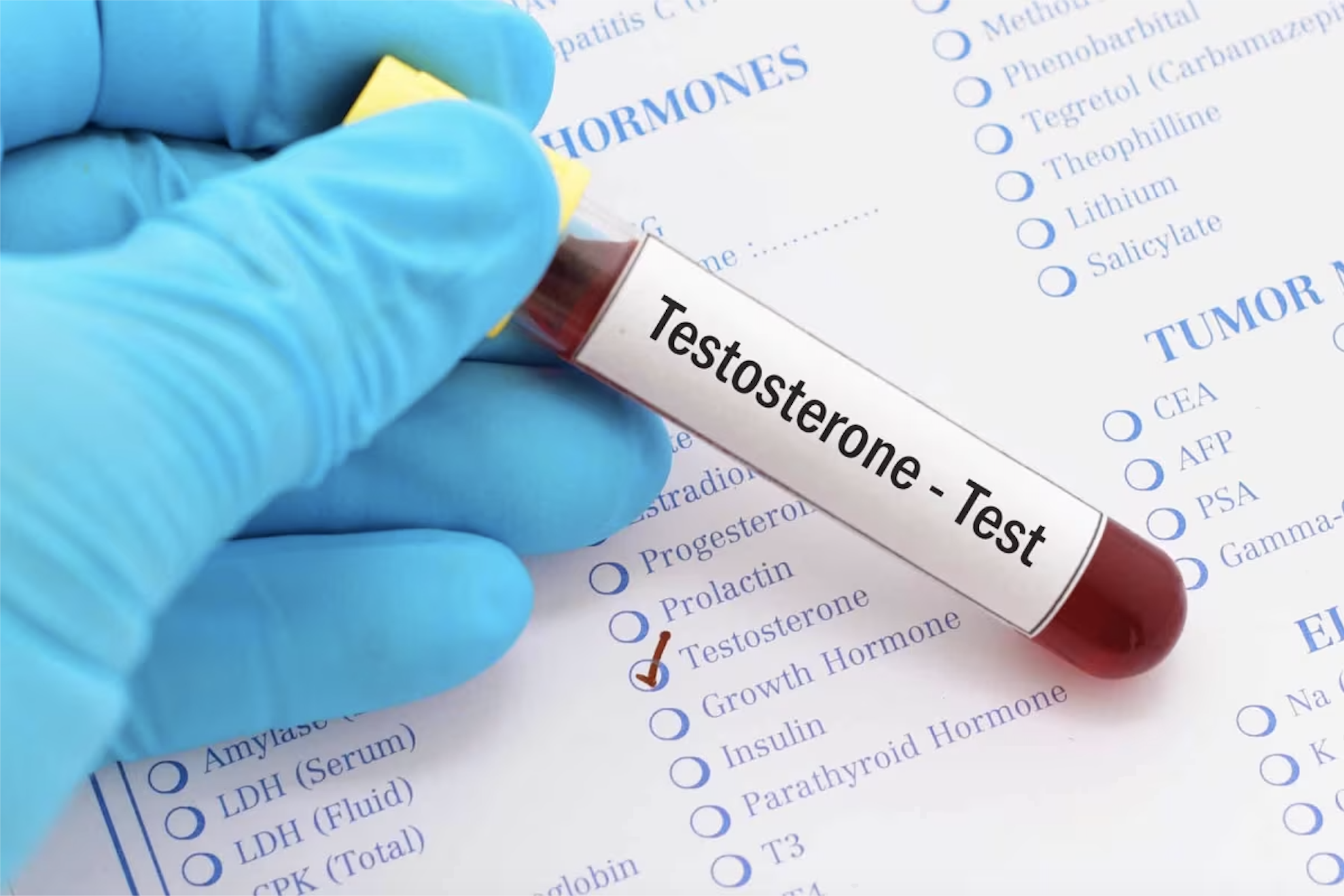How Extended Fasting Affects Testosterone