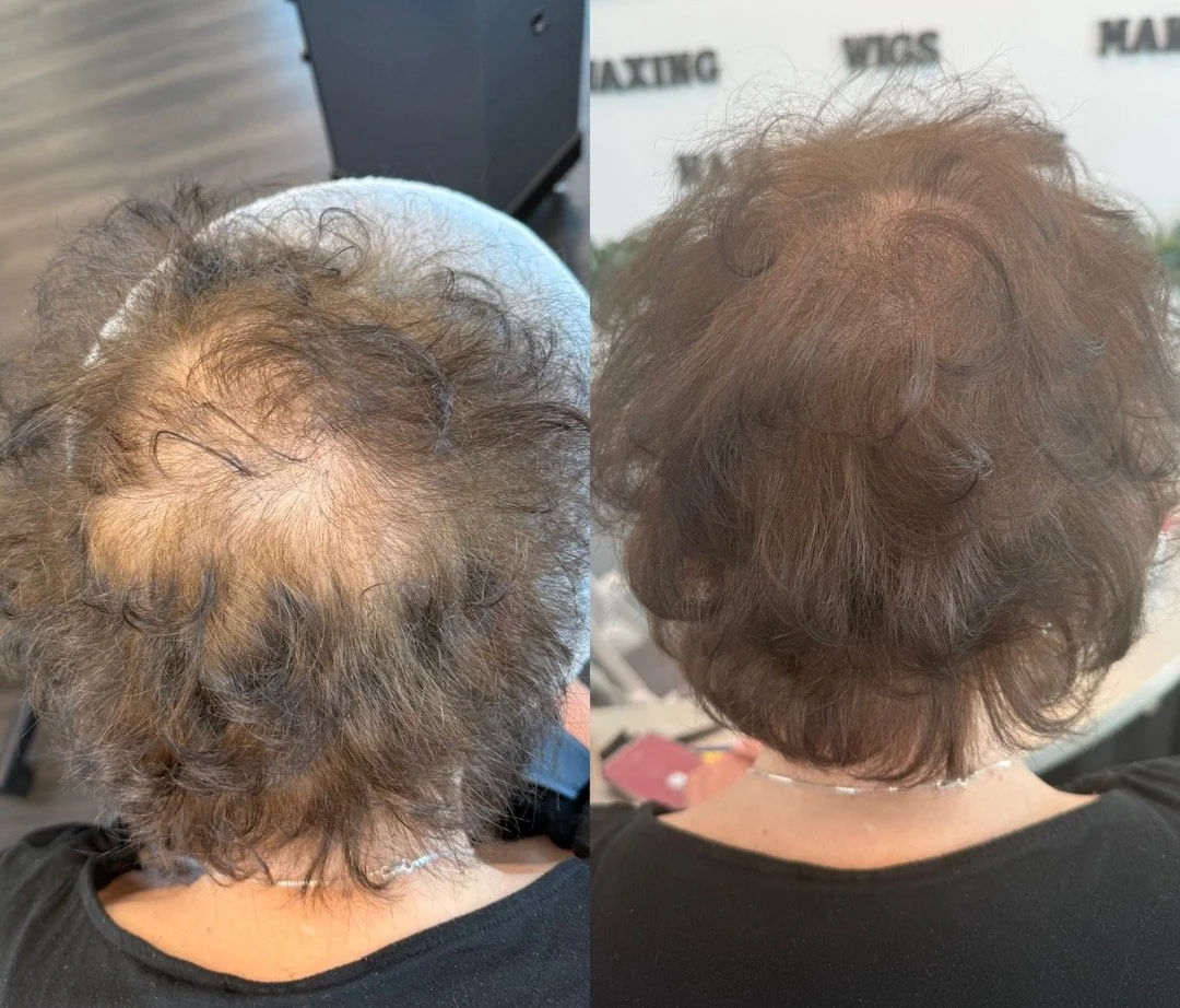 scalp micropigmentation salon amar.jpeg