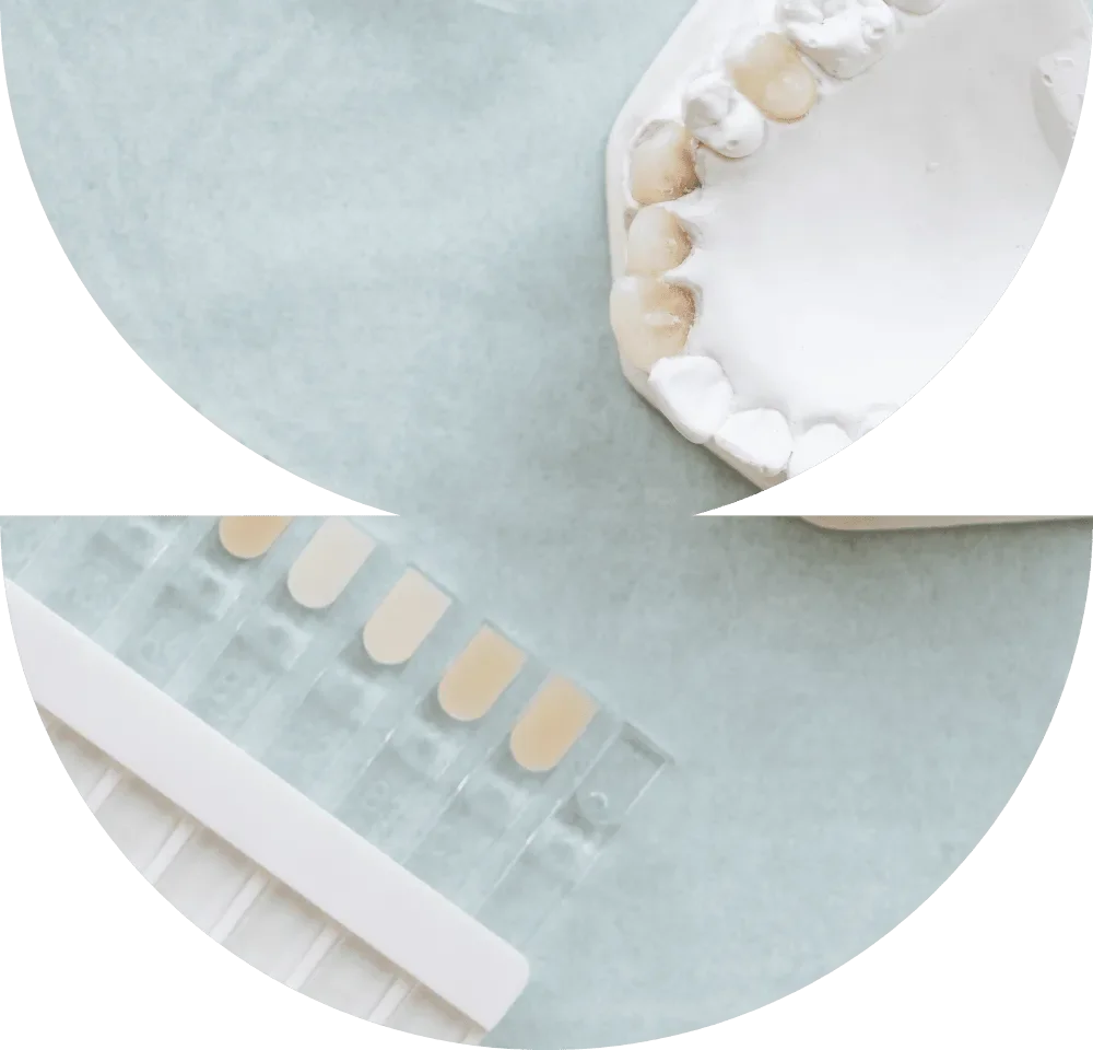 Dental shade guide samples and a dental model with teeth.