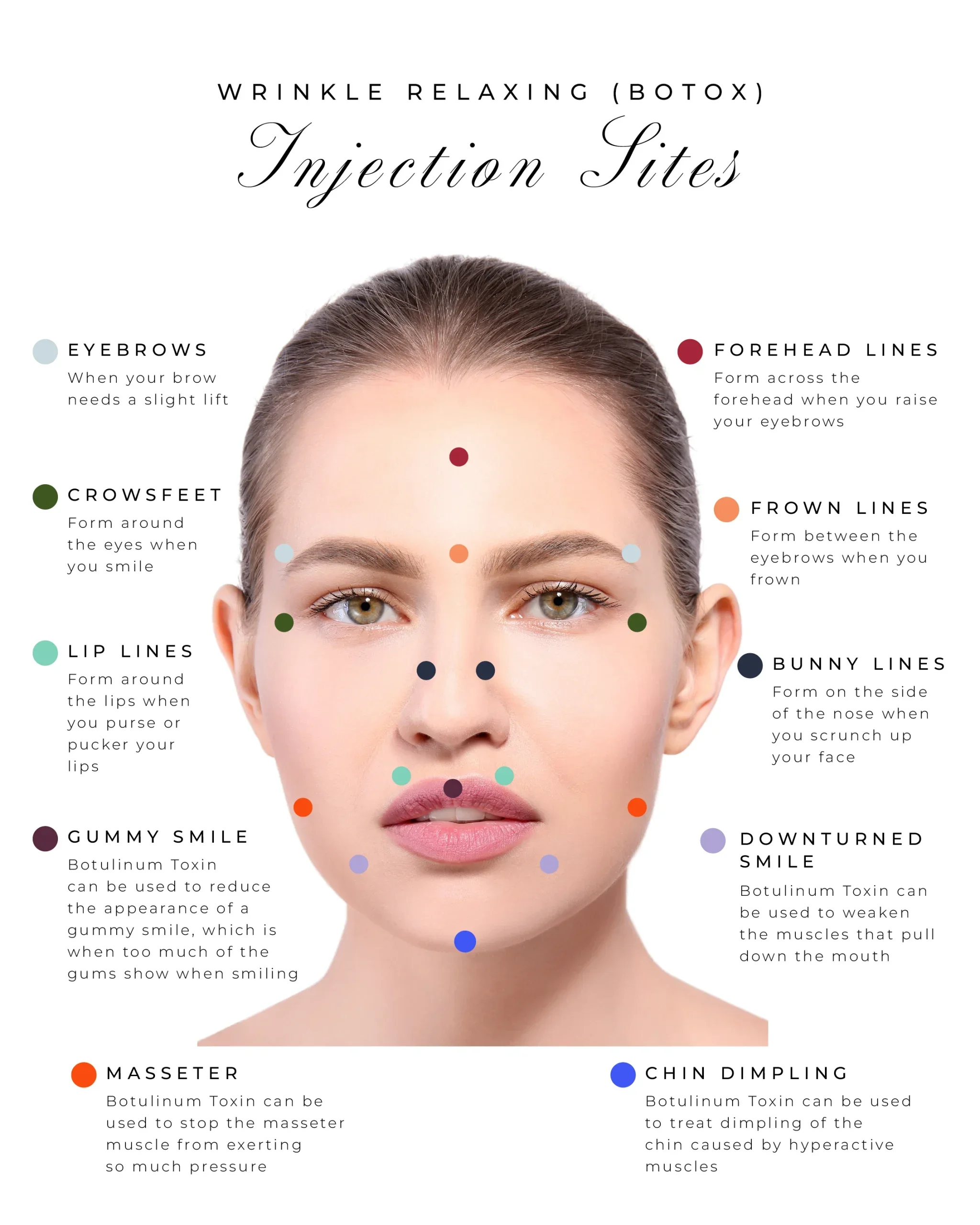 Diagram of injection sites for wrinkle relaxing botox, showing locations on a woman's face with labels for forehead lines, frown lines, bunny lines, downturned smile, gummy smile, lip lines, crowsfeet, and eyebrow fillers, each marked with colored dots.