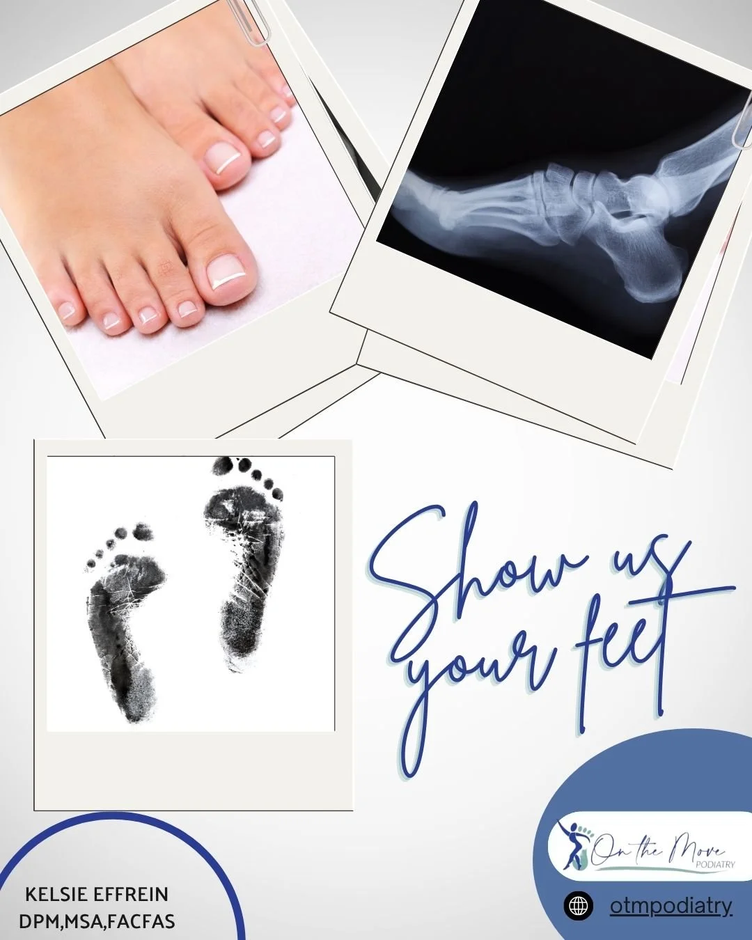 🦶 Show Us Your Feet! Whether they&rsquo;re sore, swollen, or just need some love&mdash;your feet deserve care from Phoenix's trusted foot and ankle specialist! Here to get you back On The Move! #phoenixdoctors #footdoc #phoenix #ankleinjuries #foots