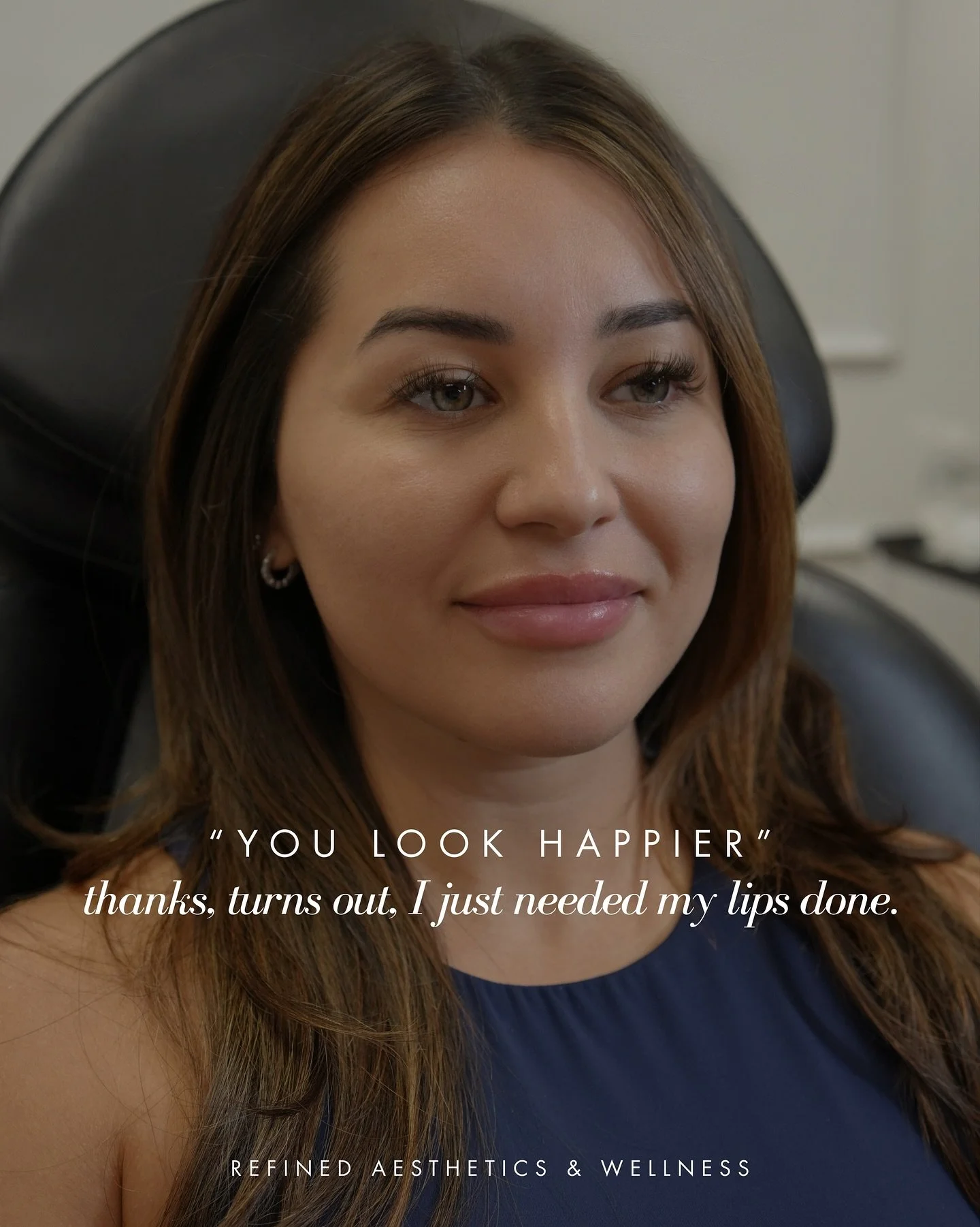 Happiest at @refinedaestheticsxwellness 👀✨ Swipe to see this stunning patient&rsquo;s before. She was in for her maintenance treatment, keeping her results fresh and refined. 

📲 Now accepting appointments | Book through the link in bio.
📍 San Ant