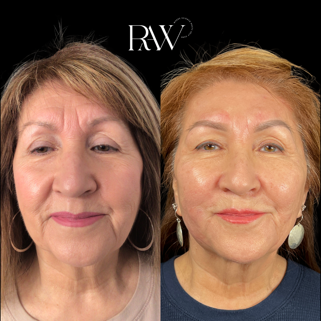 Untitled design 2.PNG