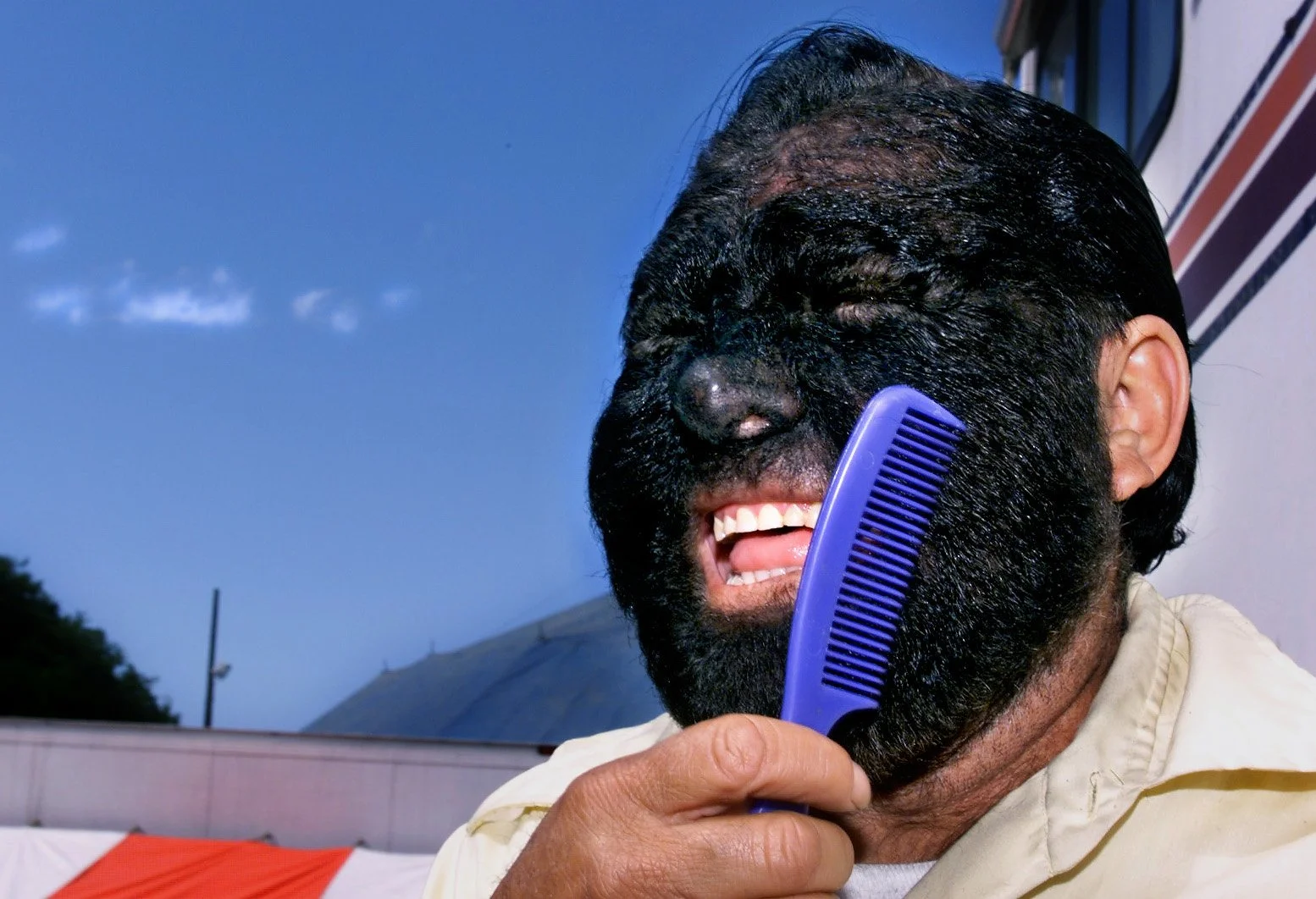 Manuel Diaz, who is billed as a ‘wolf man’ with the Sterling and Reid Brothers Circus. Diaz has a rare gene disorder causing excessive hair growth, and has been featured on television and in the Guinness Book of World Records. Diaz, from Loreto-Zacat