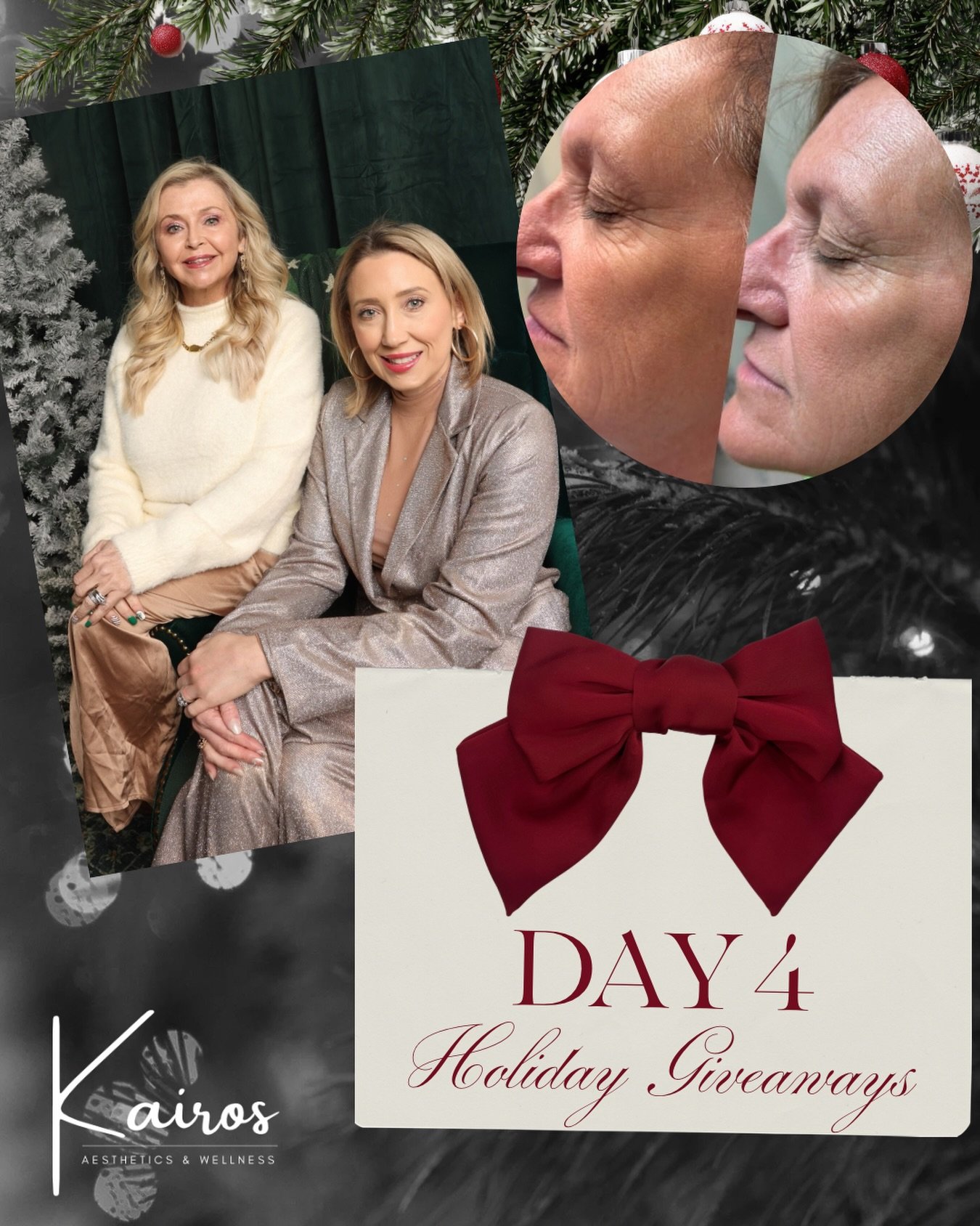 🎄✨ 12 Days of Holiday Giveaways &ndash; Day 4 ✨🎄

Your glow-up is on us! 
We&rsquo;re giving away a Chemical Peel + Microneedling Treatment to help you refresh, renew, and start the new year glowing from the inside out ✨

🎁 This powerhouse combo h