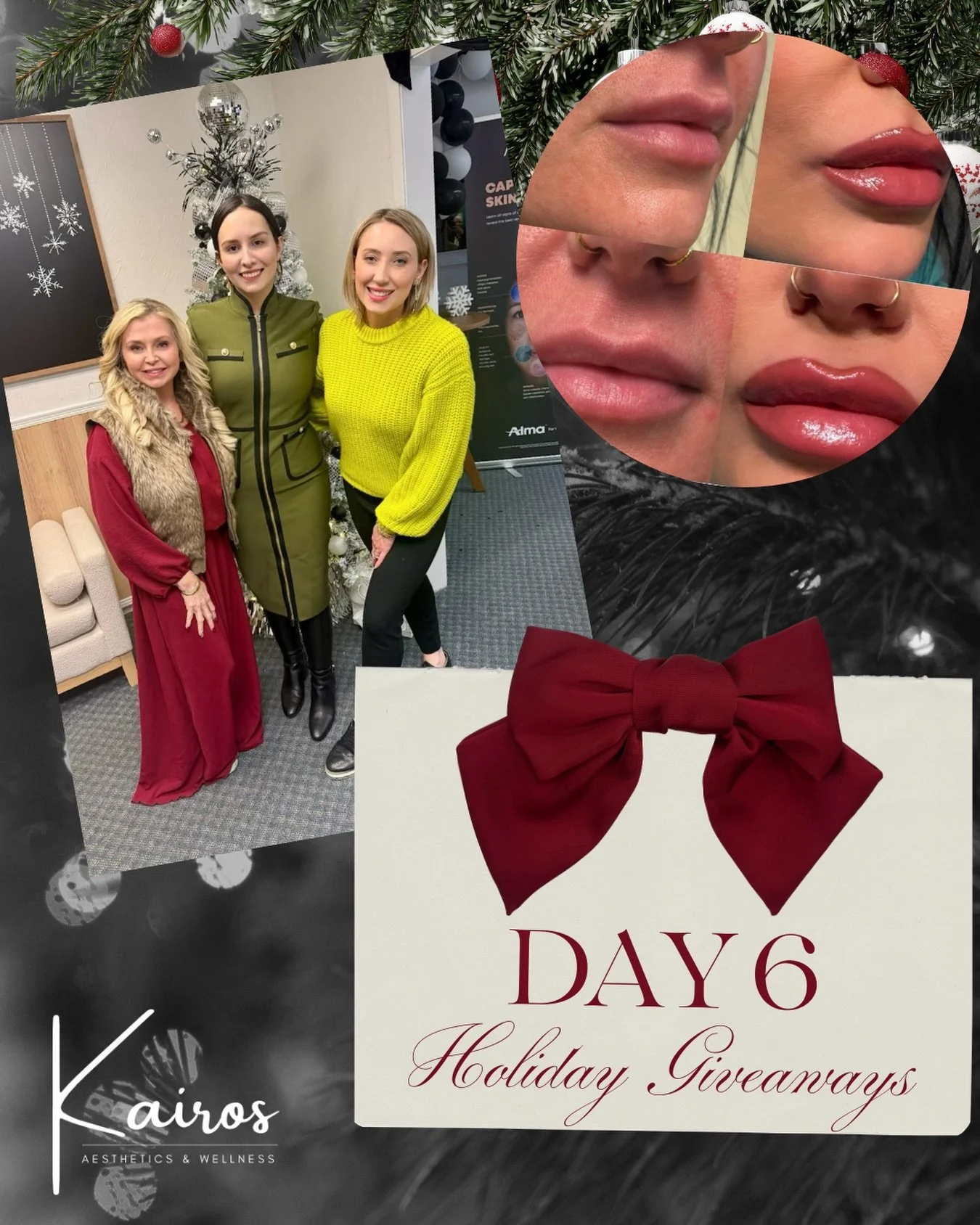 ✨🎄 DAY 6 HOLIDAY GIVEAWAY 🎄✨
Pucker up&hellip; this one&rsquo;s a fan favorite 💋You all LOVED the recent lip post so we thought it would be the perfect treatment for the next giveaway! 

We&rsquo;re giving away LIP FILLER for a perfectly plump, hy