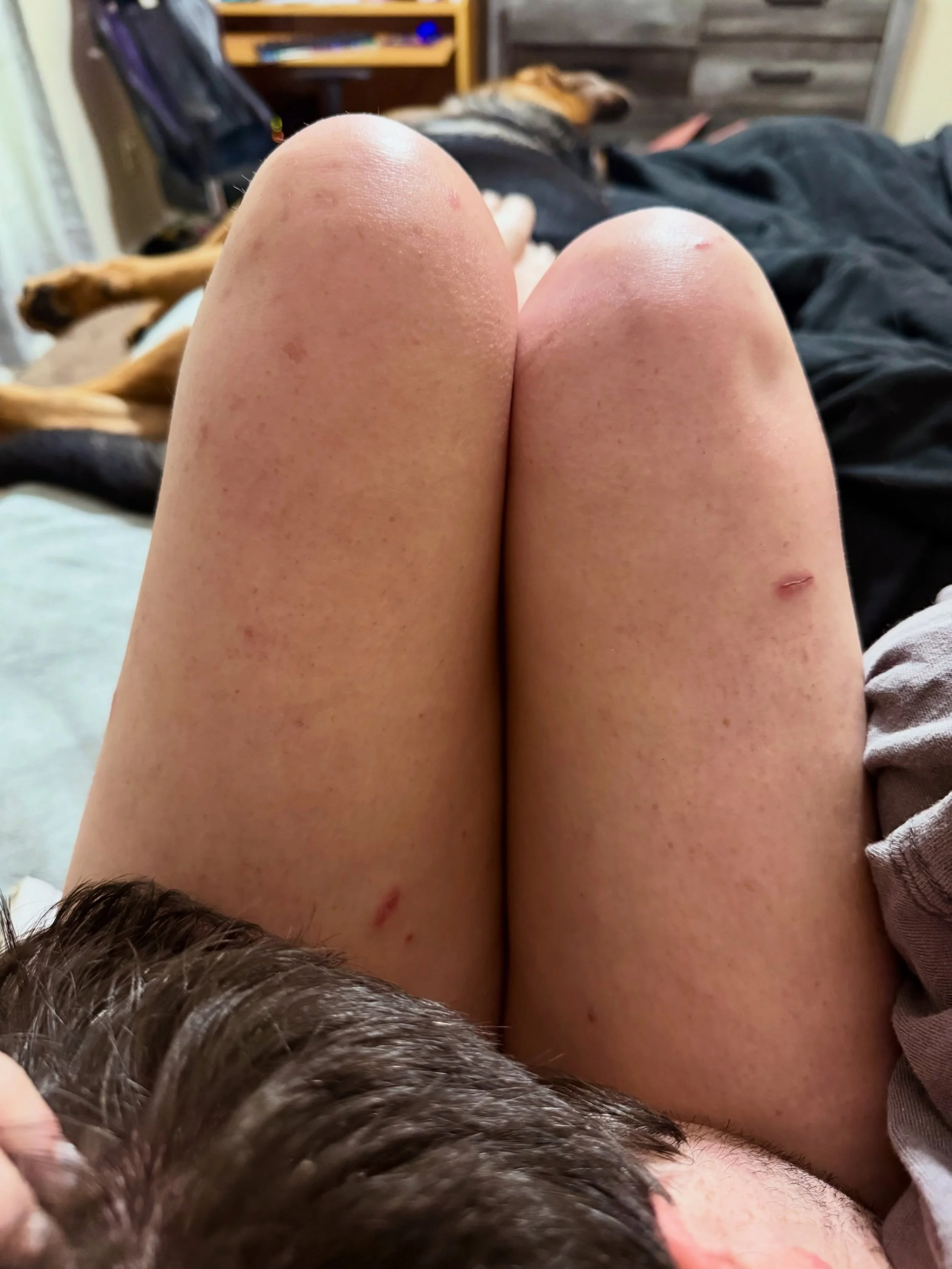 Legs seven months post #vanlife