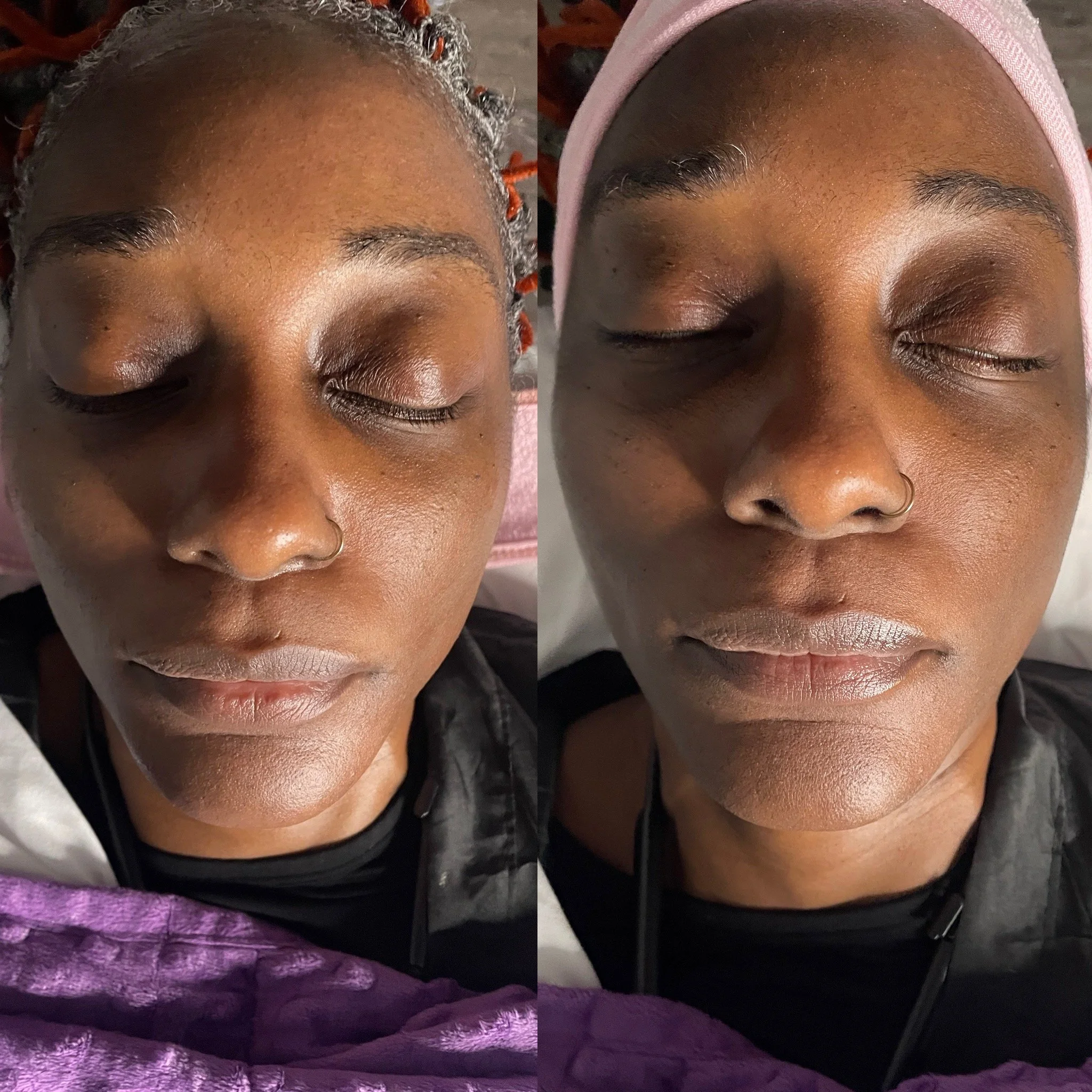 anti aging face lift treatment. Close-up of a woman with closed eyes, wearing a pink headband and a nose ring, resting with a purple blanket, showing a after and before picture  skincare treatment. shampoo and retwist with pipe cleaners