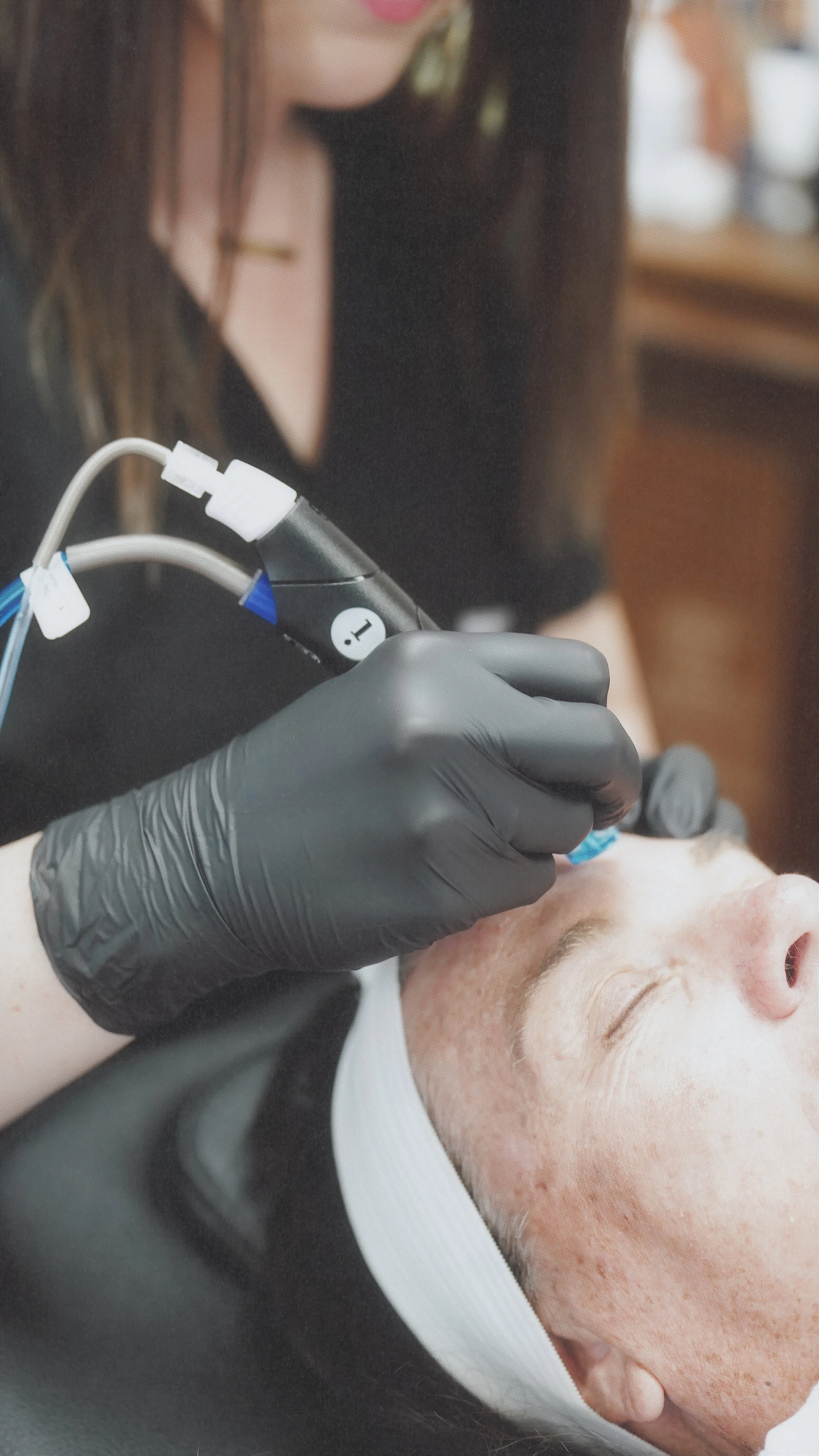 HydraFacial Cost vs Benefits: Is It Worth the Price?