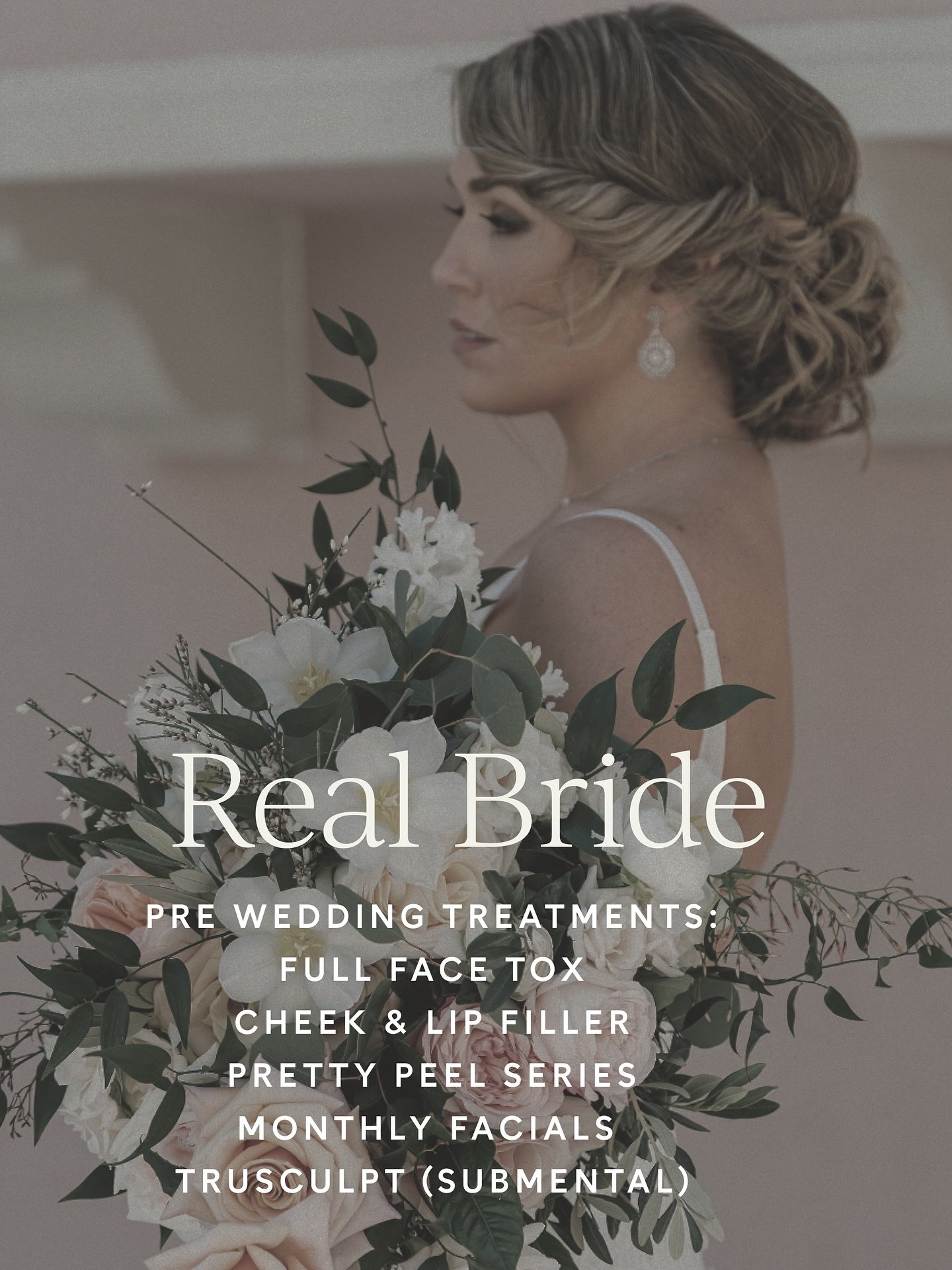 Real Brides👰🏼and what they&rsquo;ve done to wedding prep with us along the way💌 

Everyone&rsquo;s treatment and plan looks different based off goals, budget, &amp; timeline.

#bride #ratio #2025brides #2026bride #love #goldenratio #weddingplannin