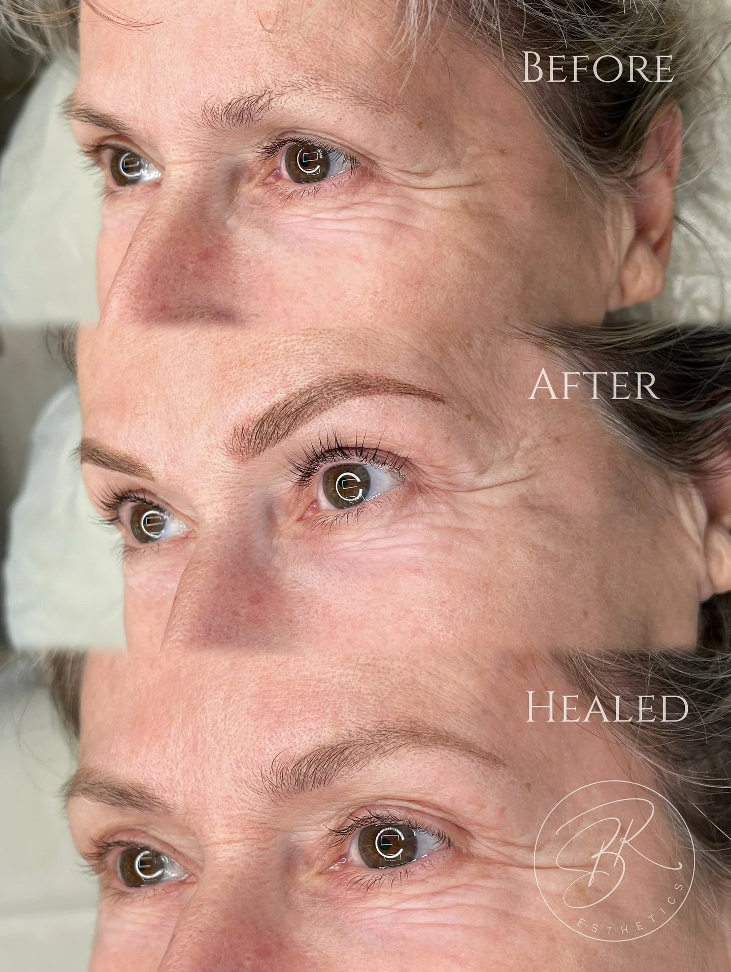 ✨ Soft. Natural. Effortless. ✨
Before ➡️ After ➡️ Healed first session results of Soft Powder Brows &mdash; the most natural-looking brow tattoo designed to subtly enhance your brows without ever looking harsh or overdone.

This gentle treatment is s