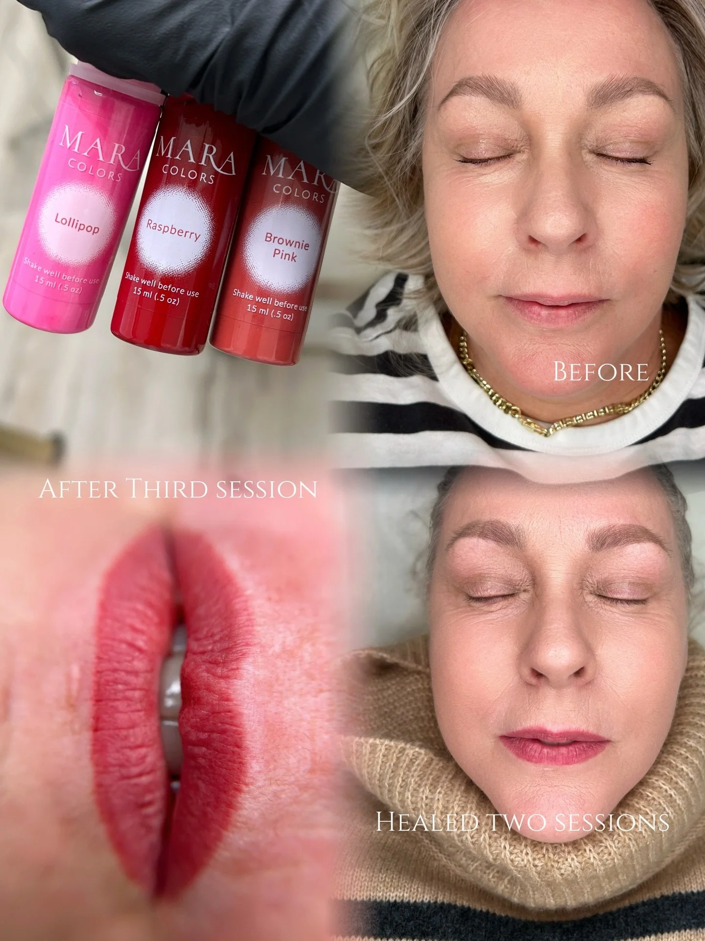 Lip blush requires patience especially if you desire a bold color. Color is built with multiple sessions. I don&rsquo;t over-work the delicate lip tissue or create unnecessary excess swelling. 
One thing I&rsquo;ve learned over the years of providing