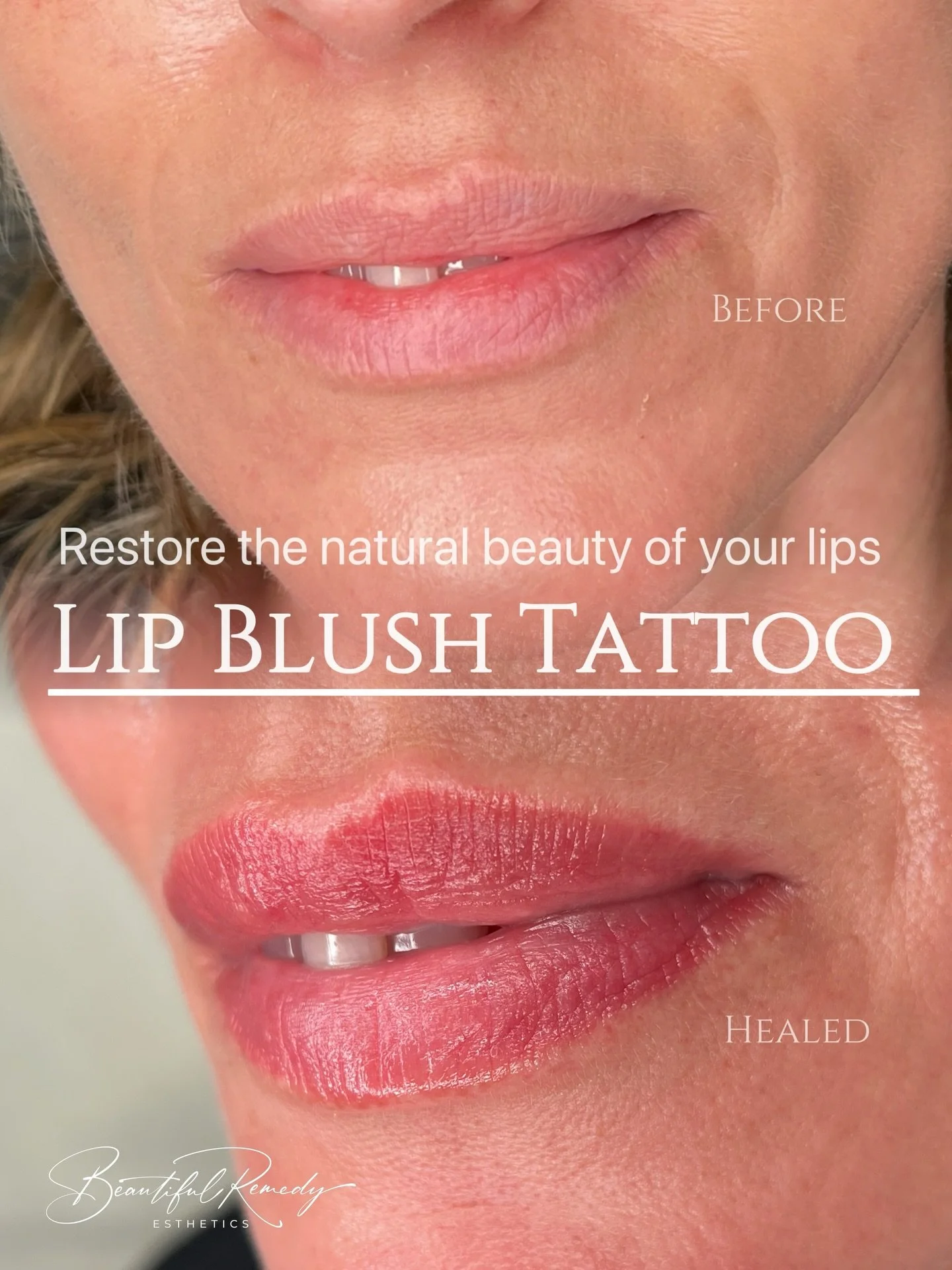 Lip Blush Tattoo
A soft wash of color designed to enhance your natural lips.

&bull; Results typically last 2&ndash;3 years
&bull; Minimal discomfort (most clients say it&rsquo;s very manageable)
&bull; Appointment time: about 3 hours
&ndash; include