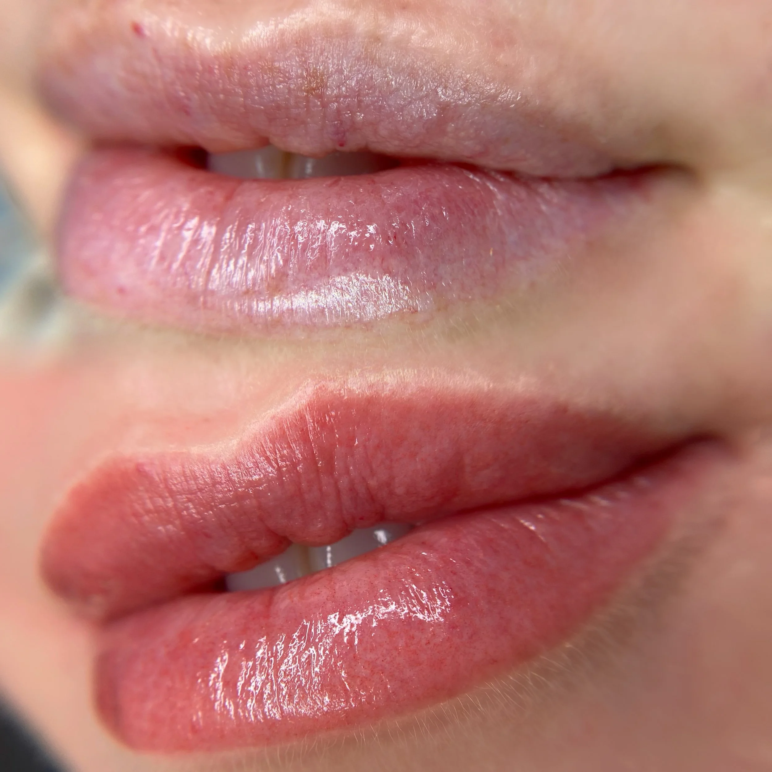 Close-up of person's lips, before and after lip blush tattoo.