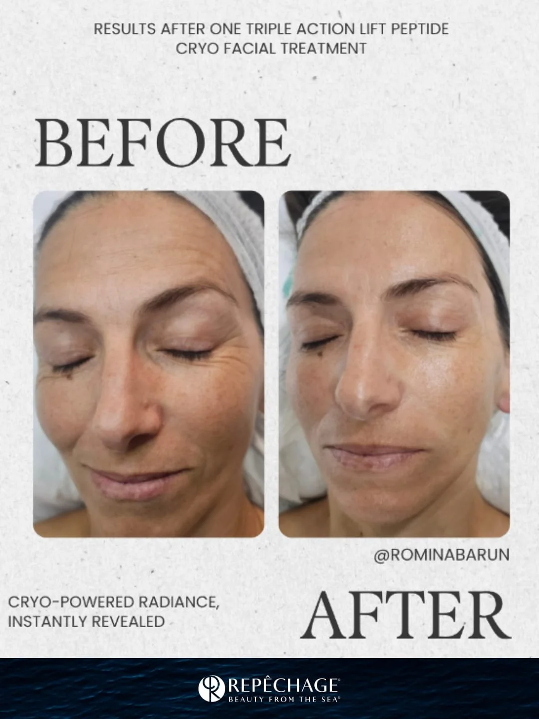 Experience the power of Cryotherapy ❄️

Introducing the NEW Rep&ecirc;chage&reg; Triple Action Lift Peptide Cryo Facial, a next-generation, science-backed treatment that redefines what advanced skincare can do.

Powered by clinical peptides, marine a