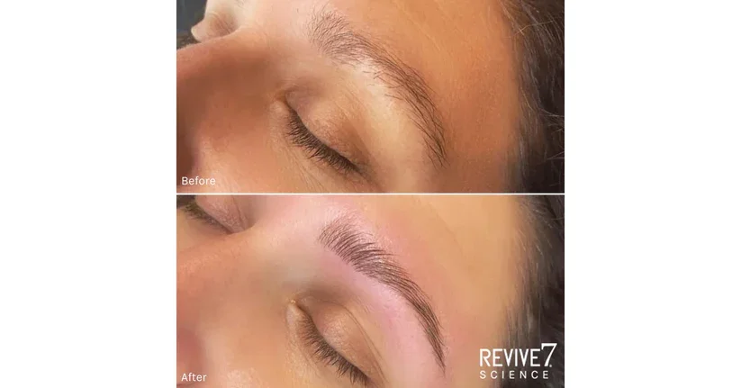 Before_After_png.webp