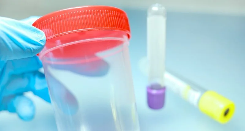 A laboratory setting showing a person wearing blue gloves holding a clear plastic container with a red lid, alongside test tubes with purple and yellow contents.