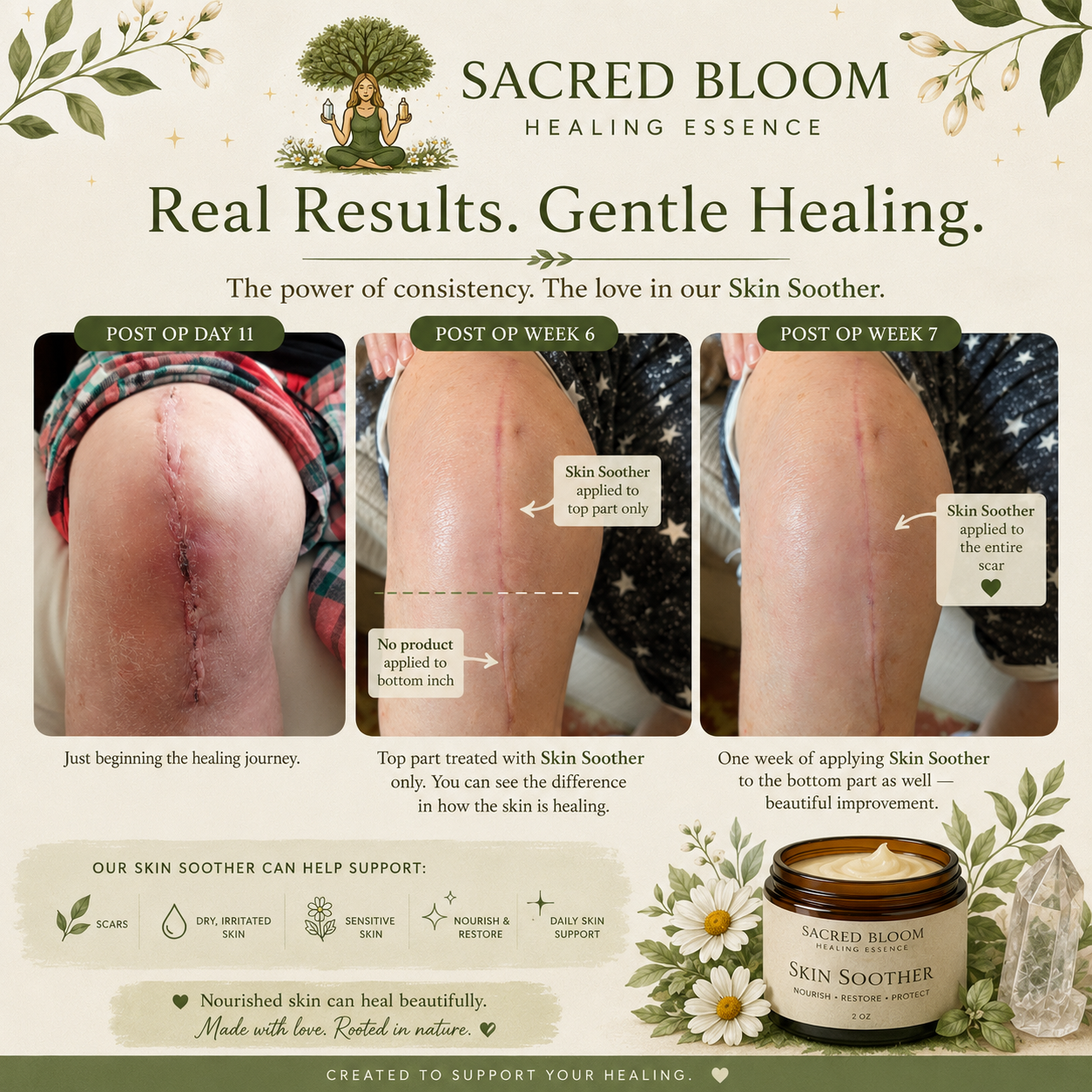 An image describing different stages of scarring after application of skin soother
