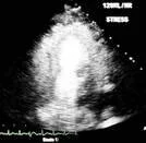 MIP Imaging