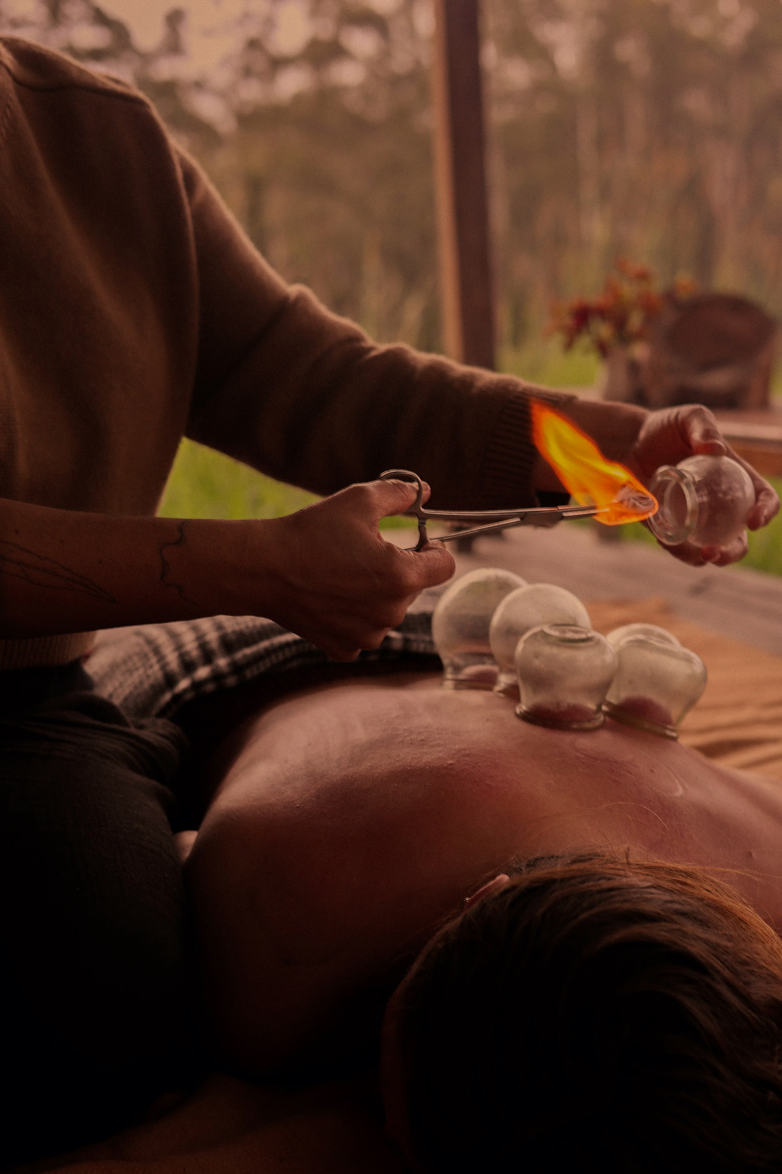 Zenthai Shiatsu cupping treatments at Talllowwood Bodywork - Byron Bay and Norther Rivers.