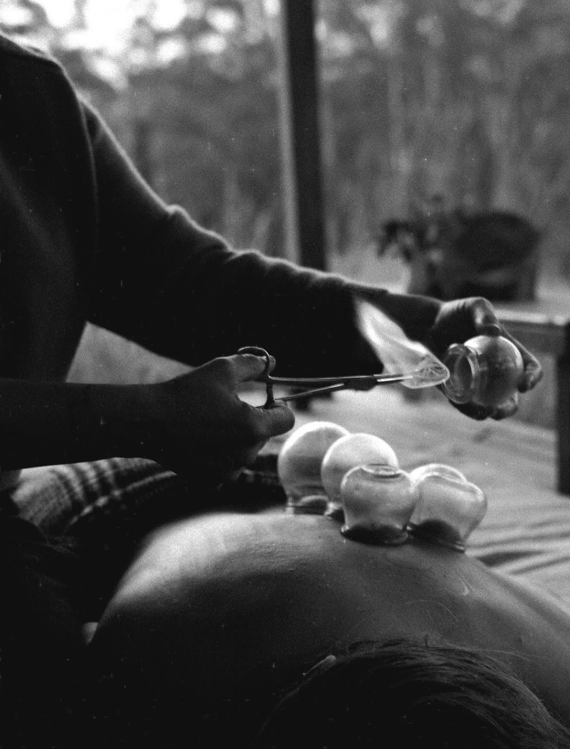 I&rsquo;ve been noticing the immense reward of combining cupping with bodywork lately. 

Drawing stagnation from the body and inviting freedom and flow. The dance between hands &amp; cups reaches further into one&rsquo;s unique needs. 

Pulling out t