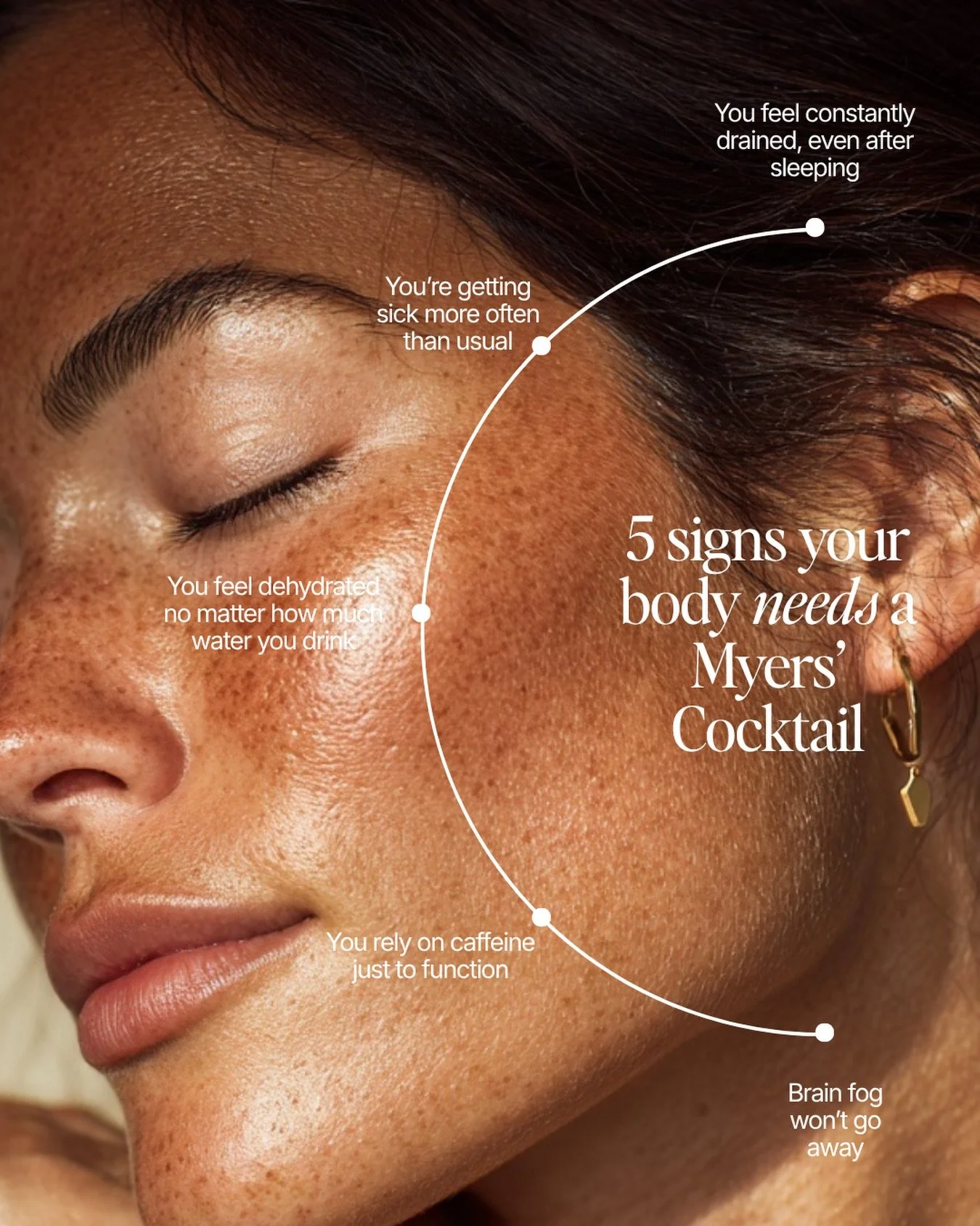 Traditionally, a Myers&rsquo; Cocktail contains a combination of:
💧Vitamin C
💧B Complex vitamins (including B12)
💧Magnesium 

Most people don&rsquo;t realize that fatigue, brain fog, and frequent illness can be linked to low vitamin absorption + d