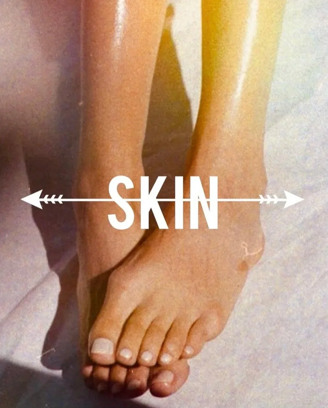 Close-up of a person's hands and feet, with the word "SKIN" overlayed in the center and arrows pointing outward.