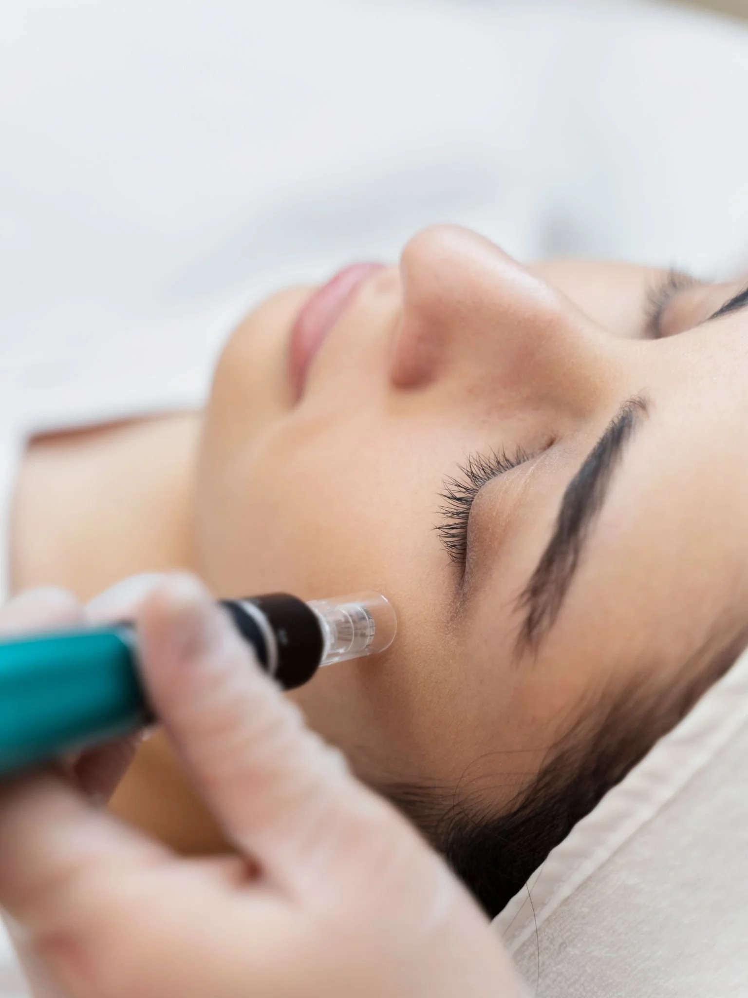 A woman lying on her back while a medical professional administers a micro needling injection near her eye.