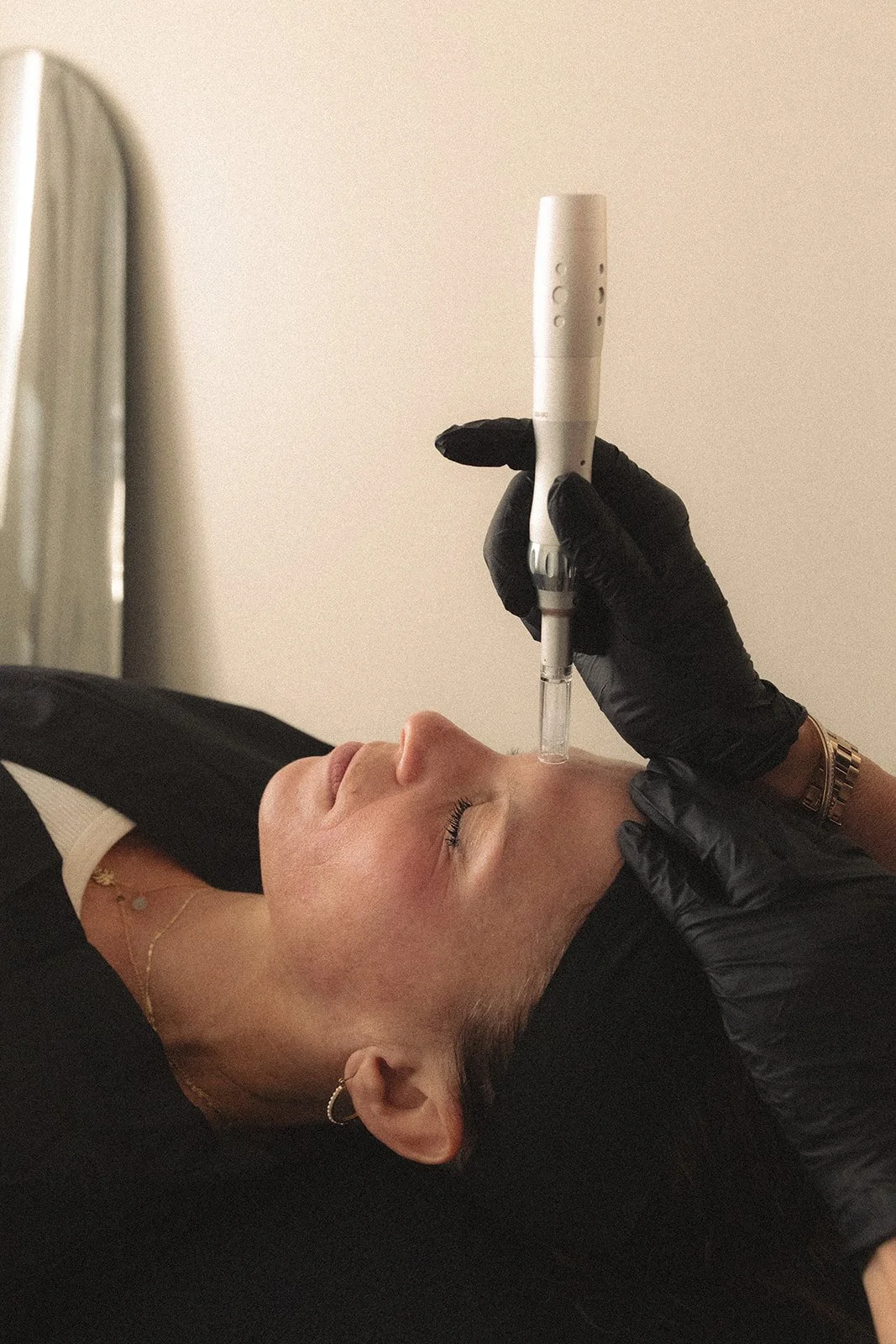 Microneedling for firmer, more even skin tone, anti-aging, acne, scarring, skin health