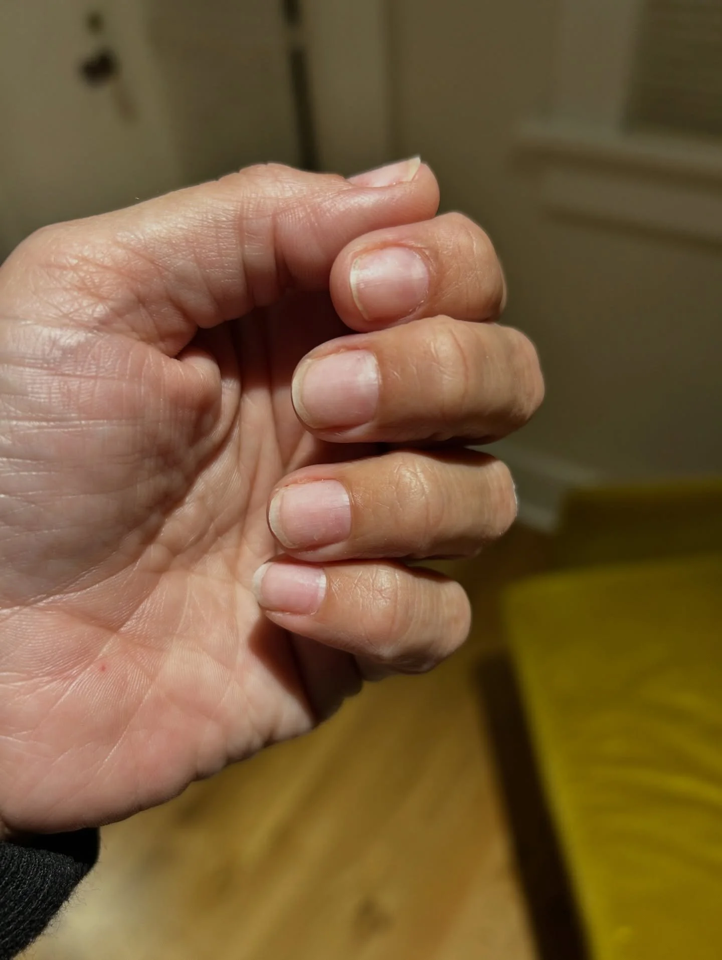 These are my bare nails with freshly removed gel. No manicure. No top coat. No oil. Just trimmed.  I do this from time to time to check in on the health of my nails and all looks good 👍. 

One thing I learned while studying for my exam was that most