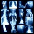 The Limitations of Imaging: Why Your MRI Doesn't Tell the Whole Story