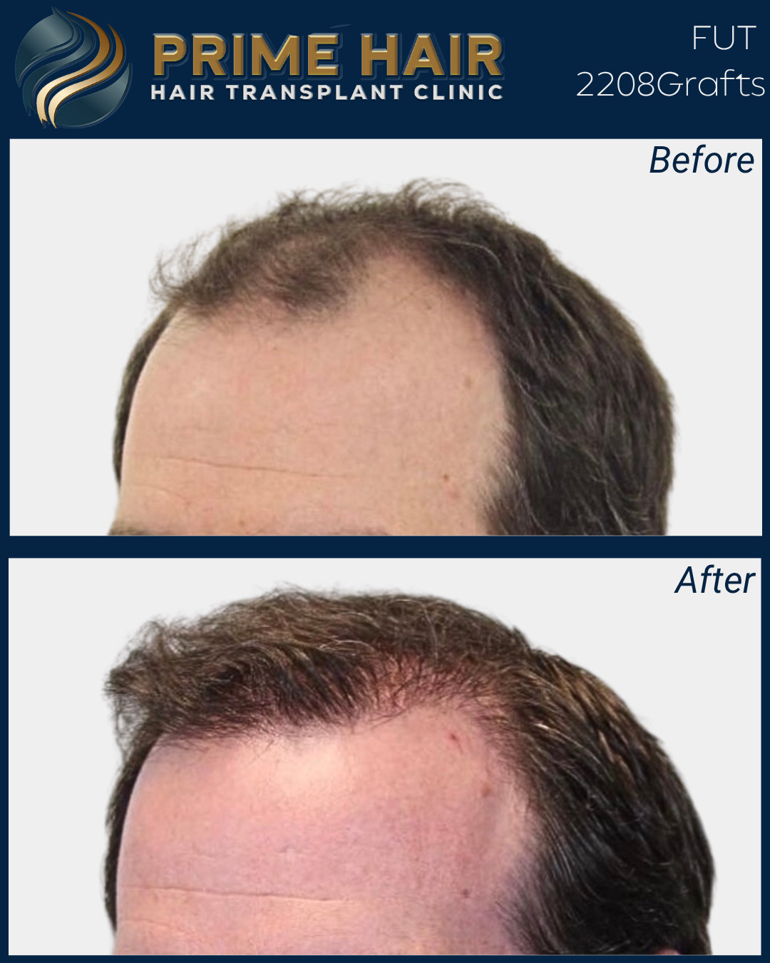 45.png