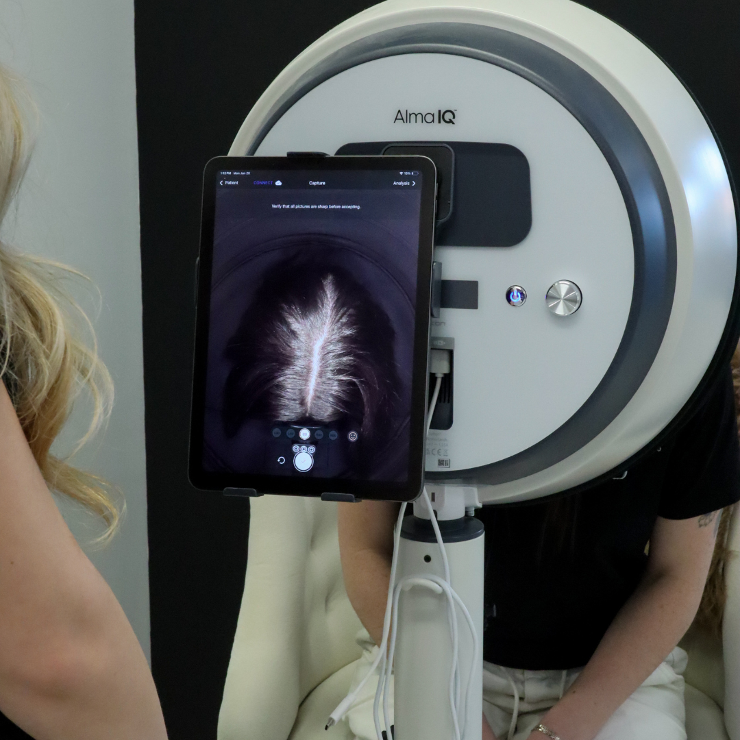 A person undergoing a hair scan using an Alma IQ device with a tablet showing a close-up image of a scalp.